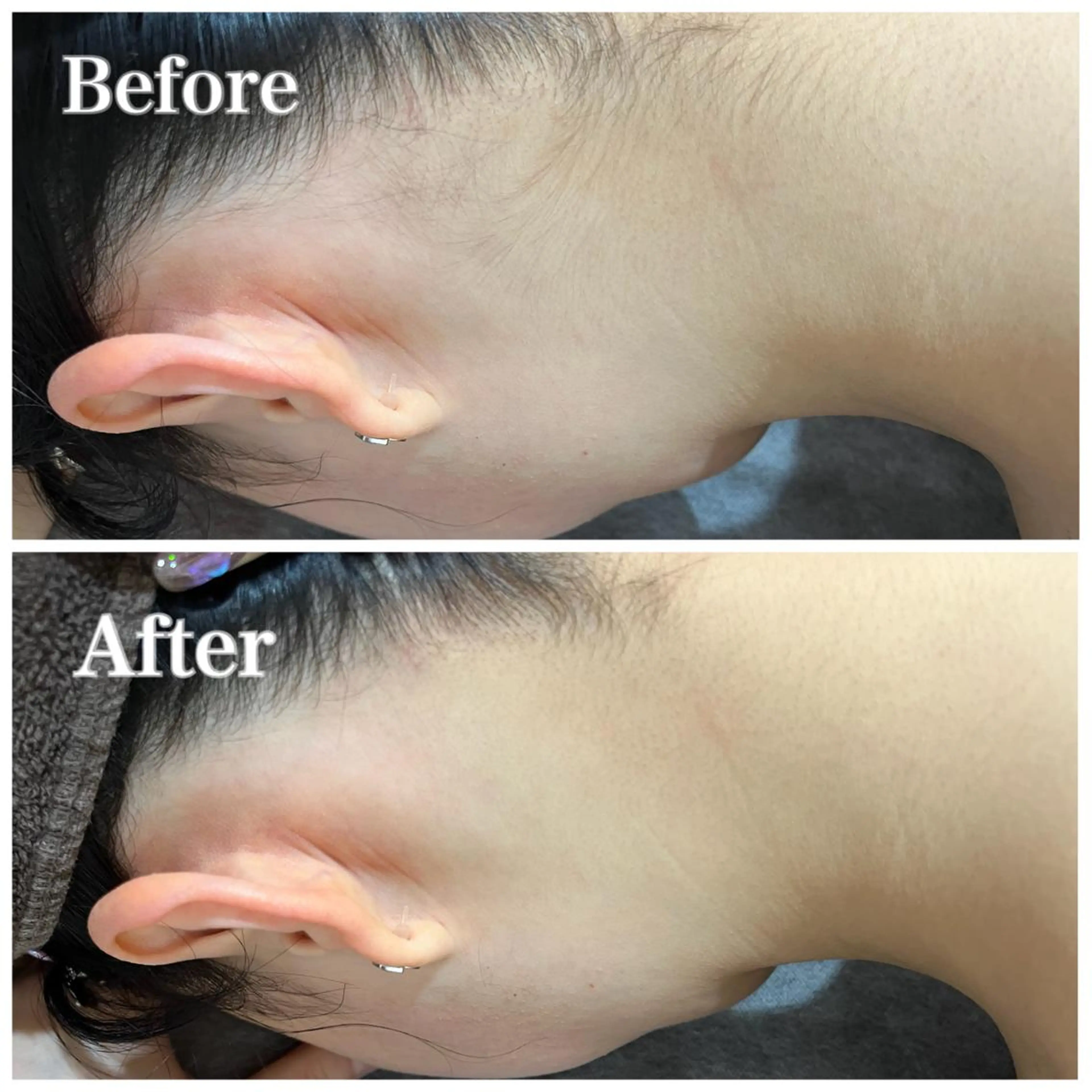 脱毛サロン fam.豊澤柚良のエステ・リラクイメージ