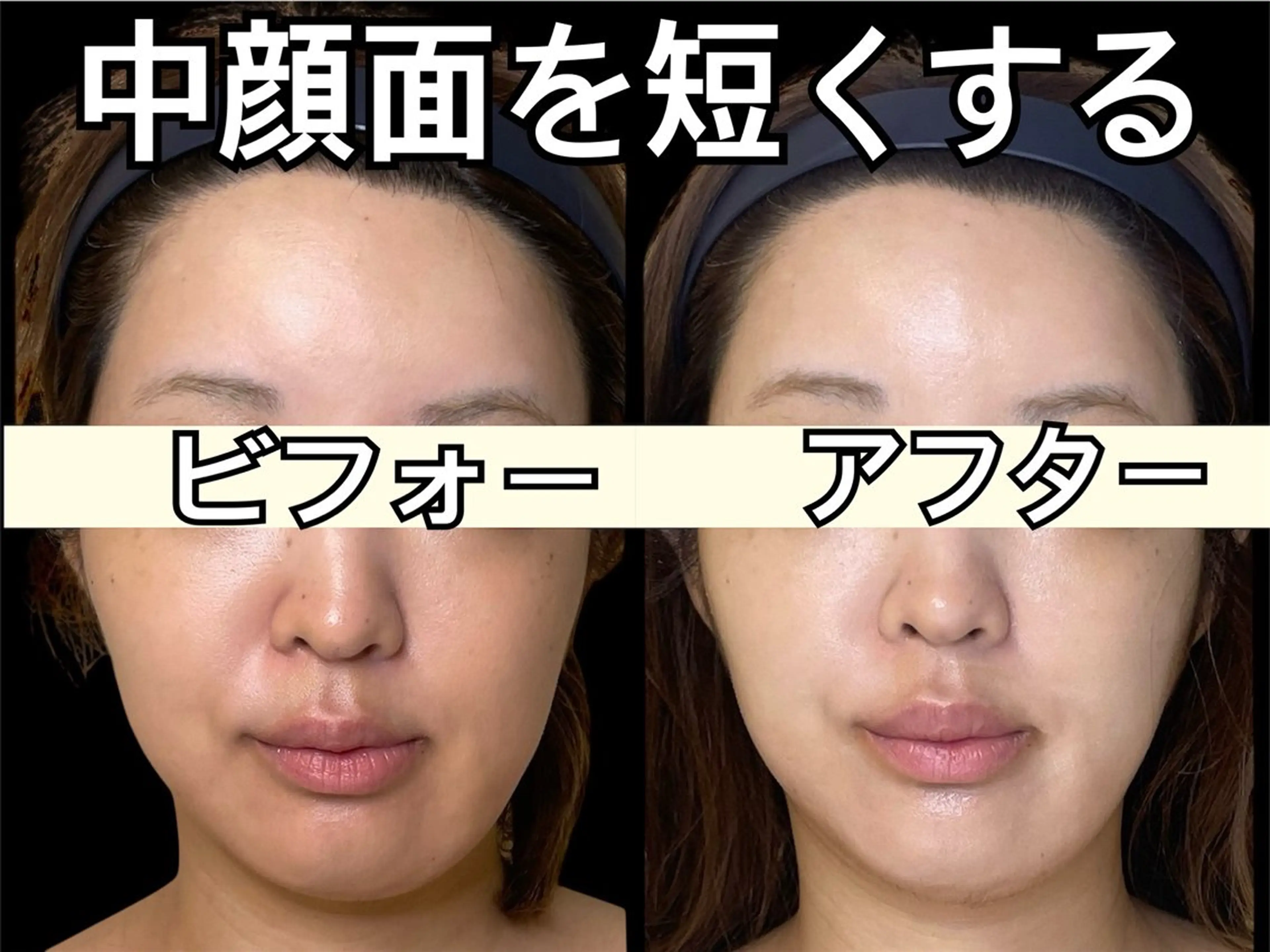 小顔専門看護師クリニカルサロンCOCO所属・小顔と美肌サロン クリニカルサロンココのエステ・リラクイメージ