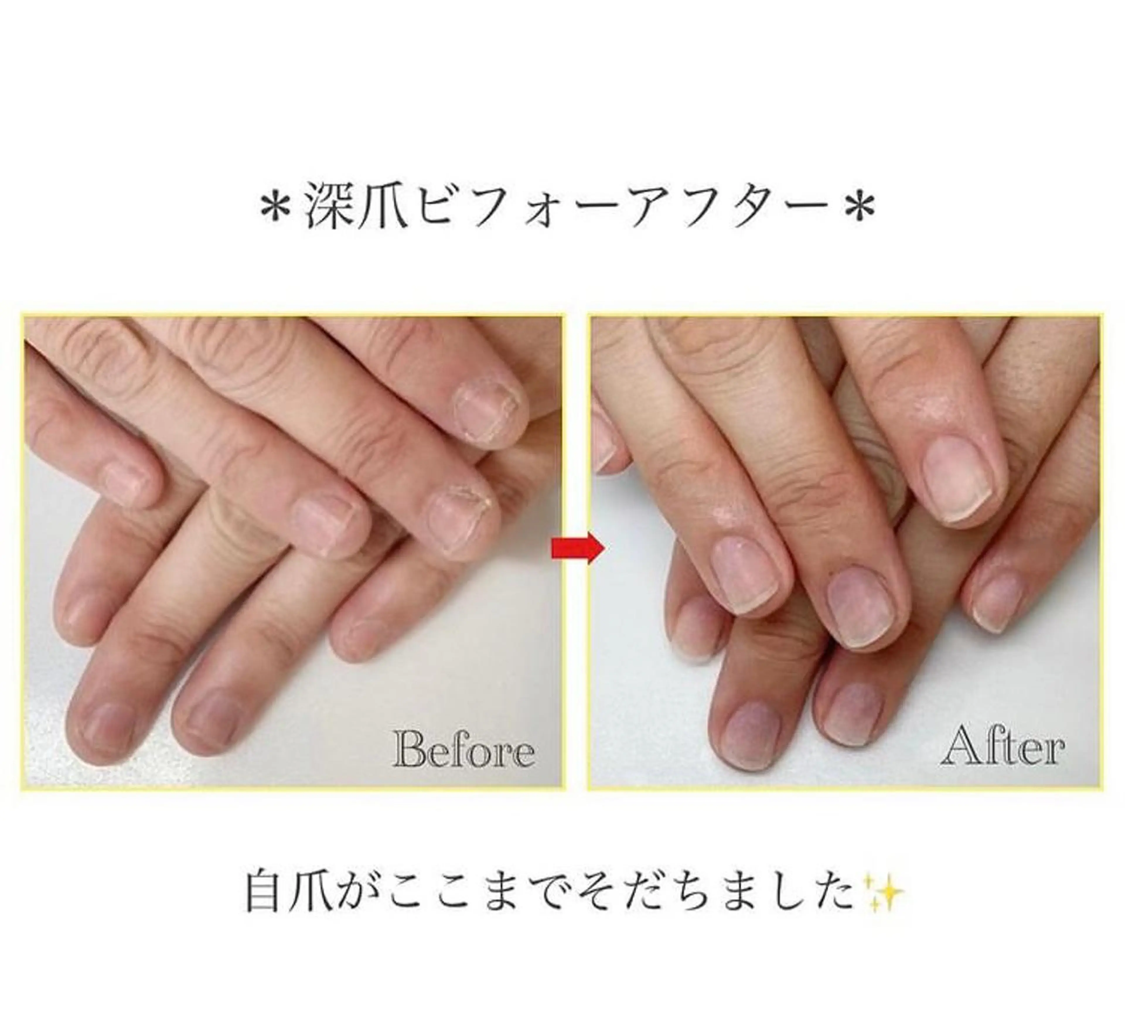 ネイル ネイルサロン アリュームのネイルデザイン