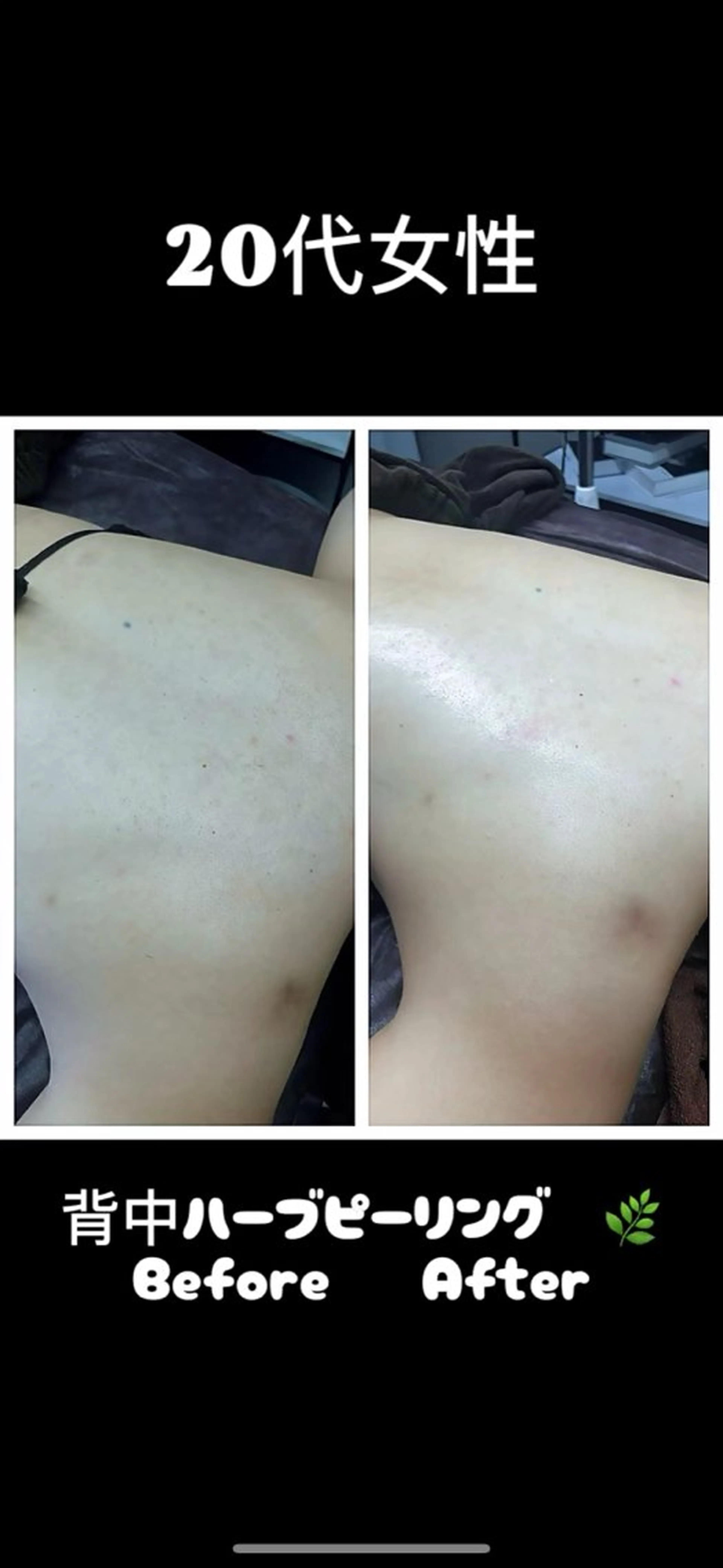 エステ 美容整体・塗る漢方・フェイシャルRechica所属・痩身・脱毛・肌管理 Rechica心斎橋のエステ・リラクイメージ