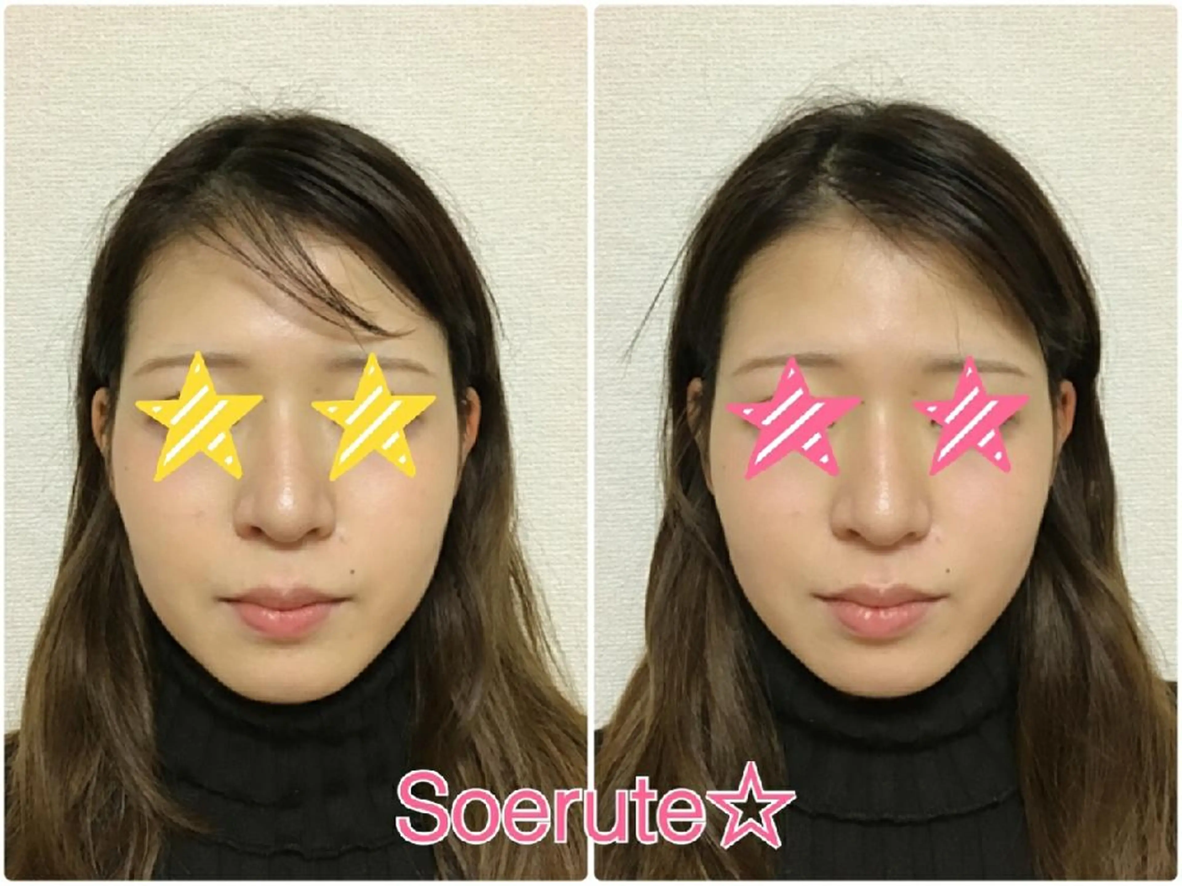 エステ リラク Soerute☆ ソエルテ 井上みえのエステ・リラクイメージ