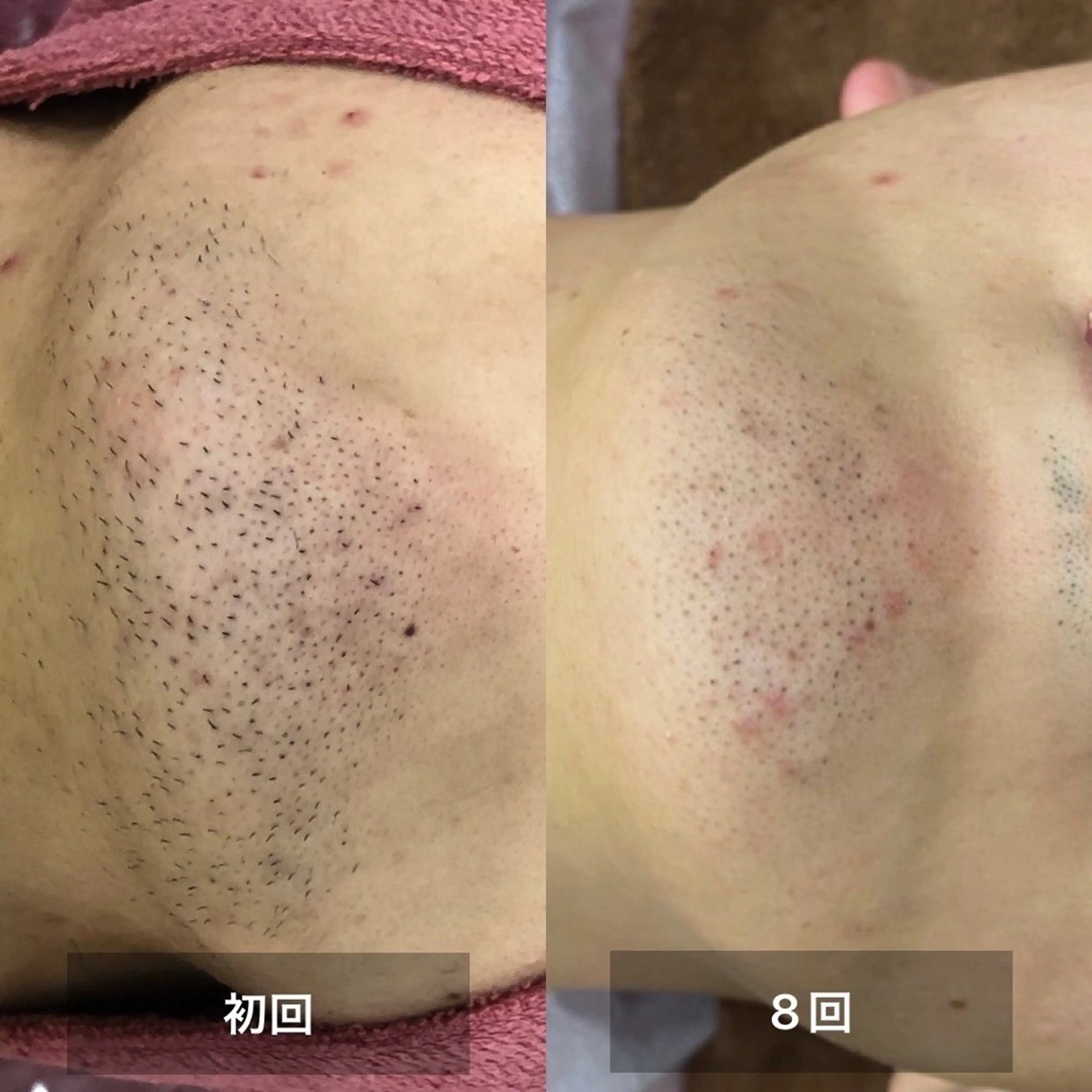 美肌，美ボディ，脱毛 サクラチャンスパのエステ・リラクイメージ