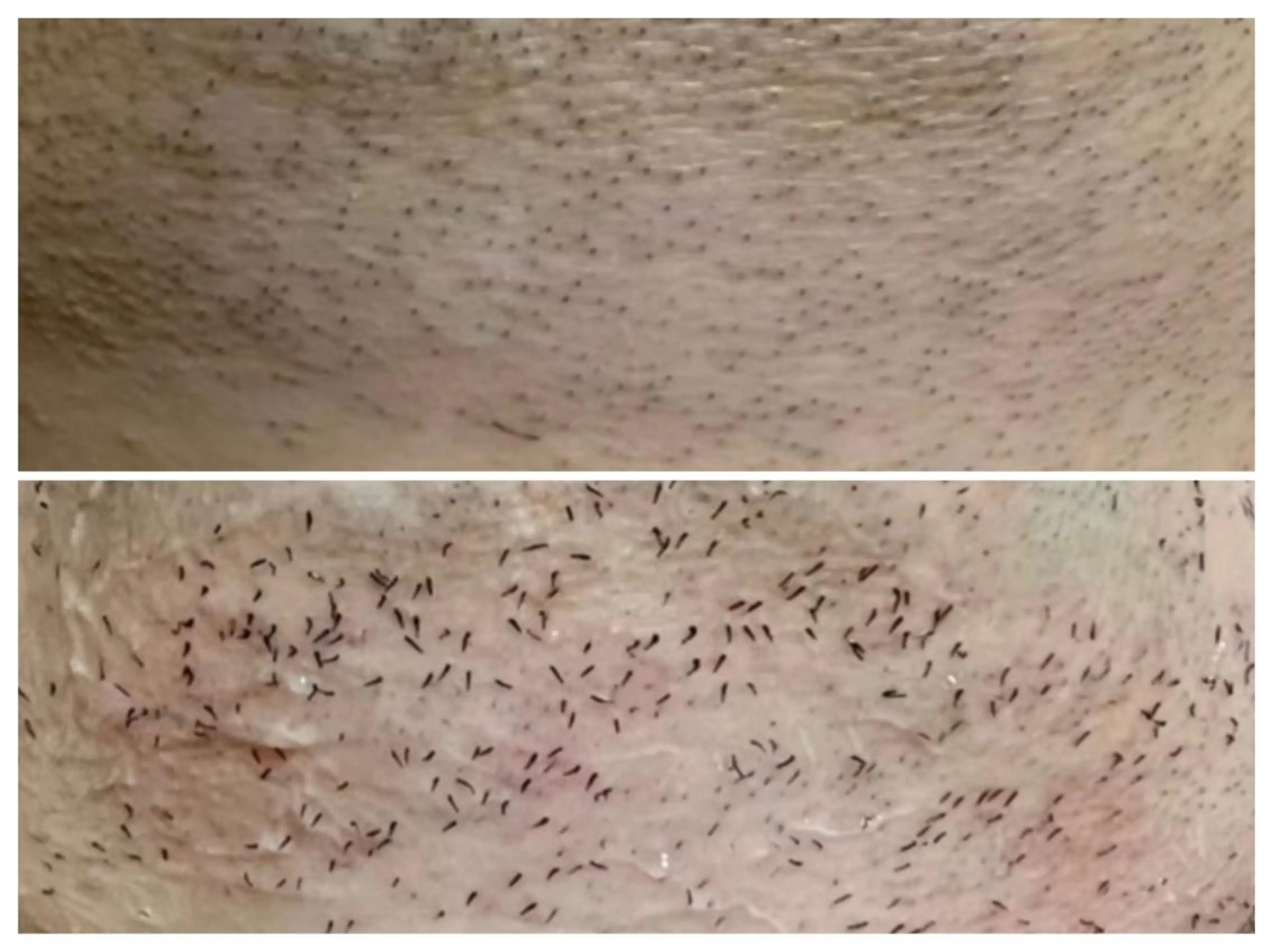 肌管理脱毛ピーリング CDFAkasakaのエステ・リラクイメージ