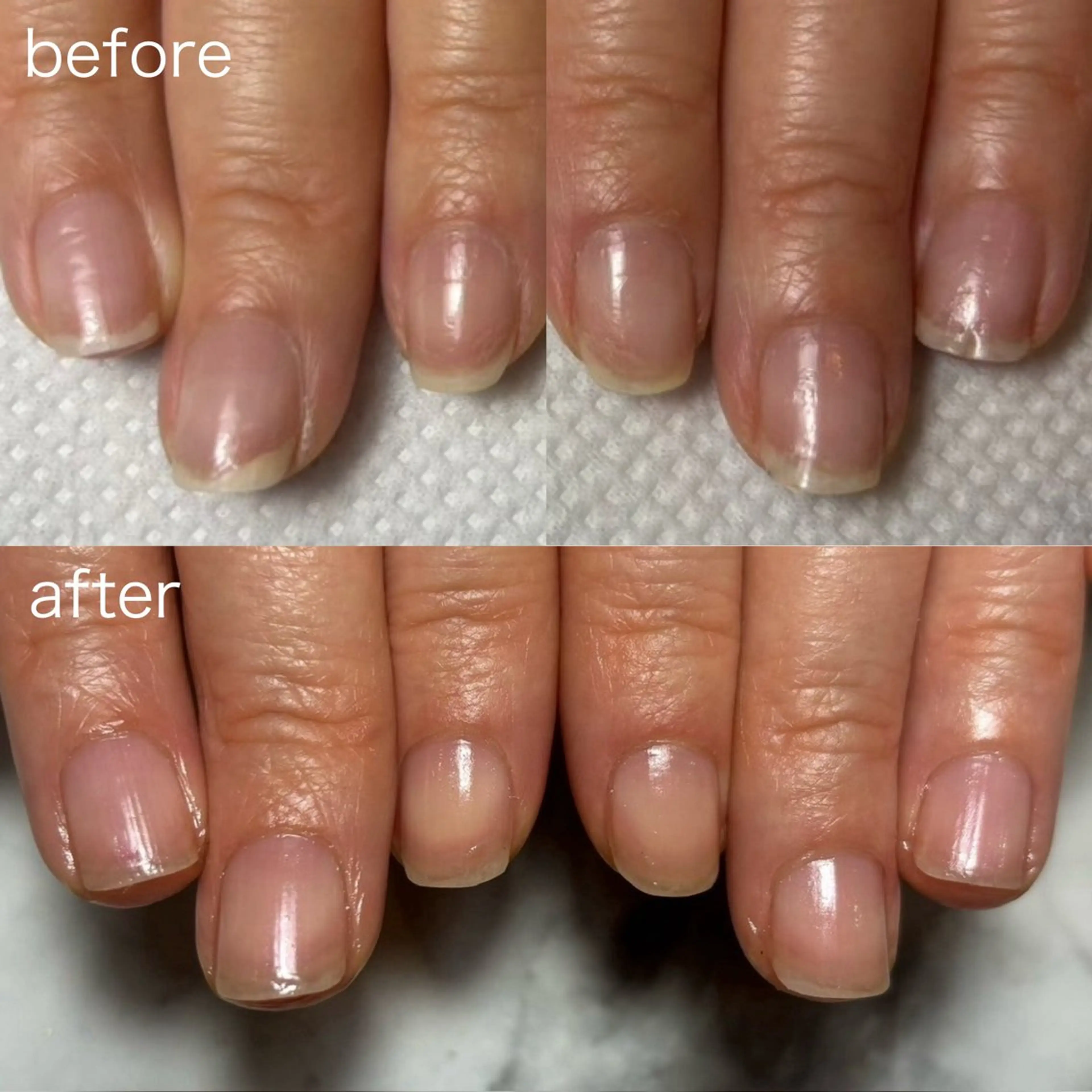 ネイル 自爪育成/深爪矯正 salon fam_のネイルデザイン