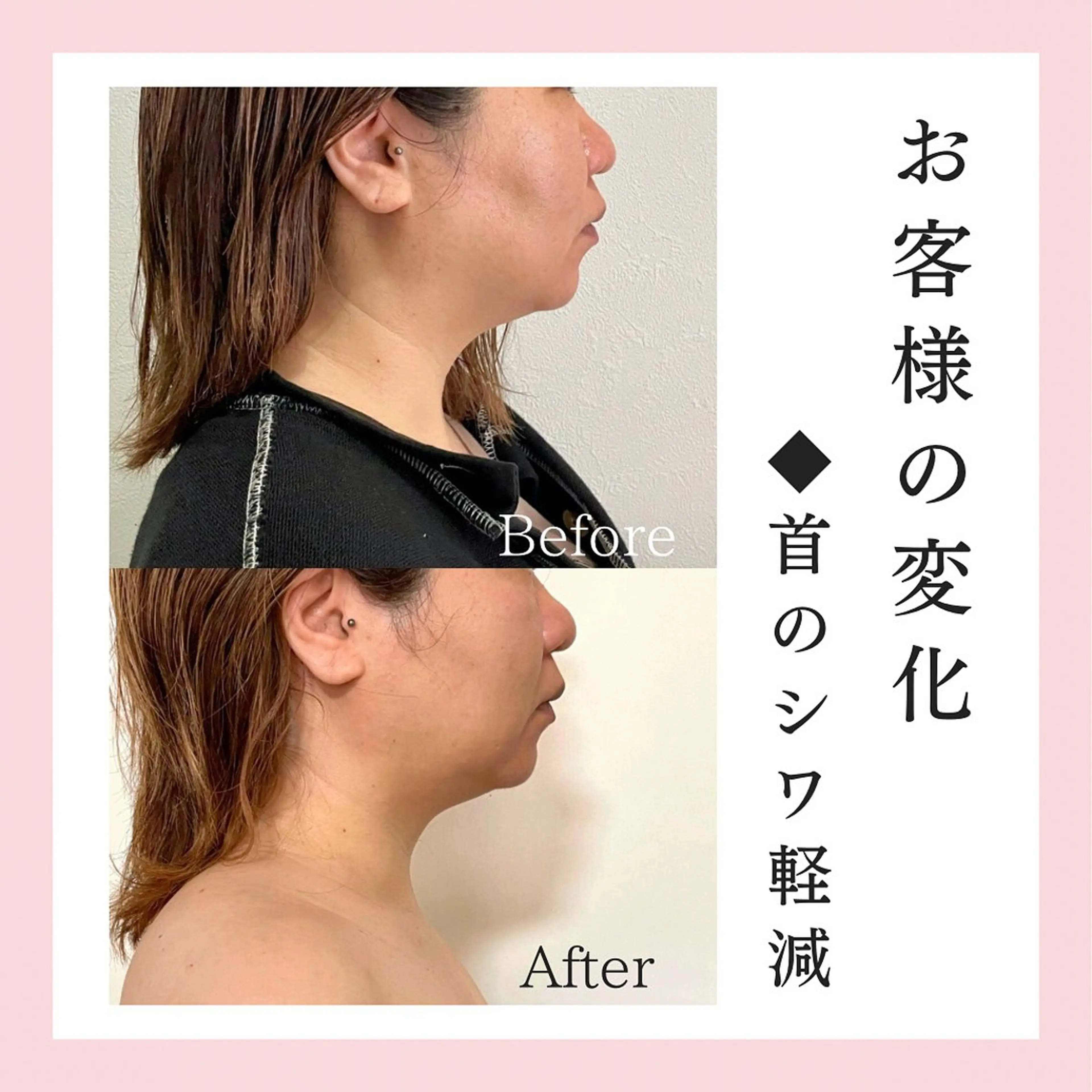 エステ リラク Private SalonOboraのエステ・リラクイメージ