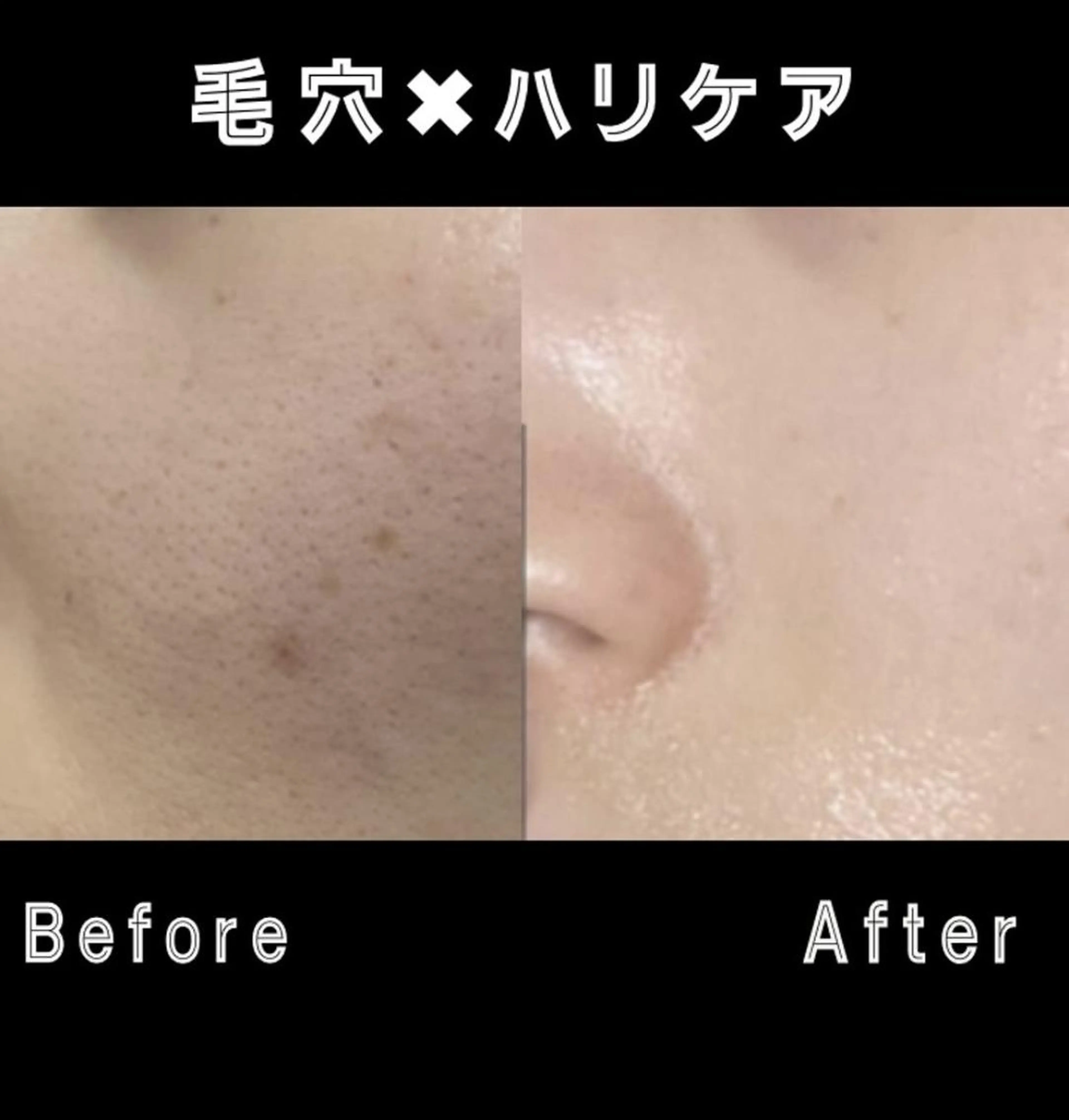 エステ リラク 🎀美肌サロン レイビス川崎店🎀のエステ・リラクイメージ