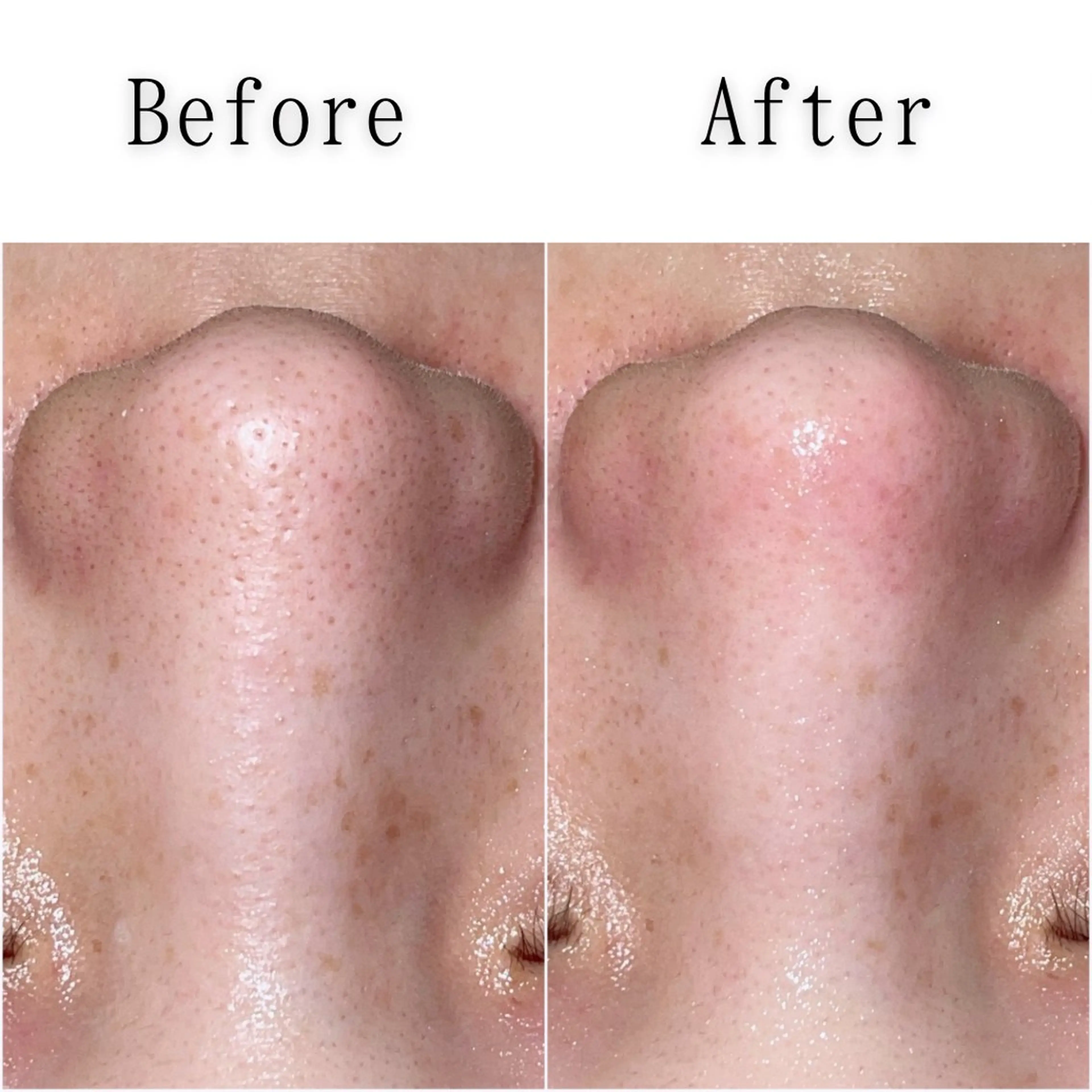 エステ SELF  BEAUTY gracia浦添店所属・gracia 浦添店のその他イメージ