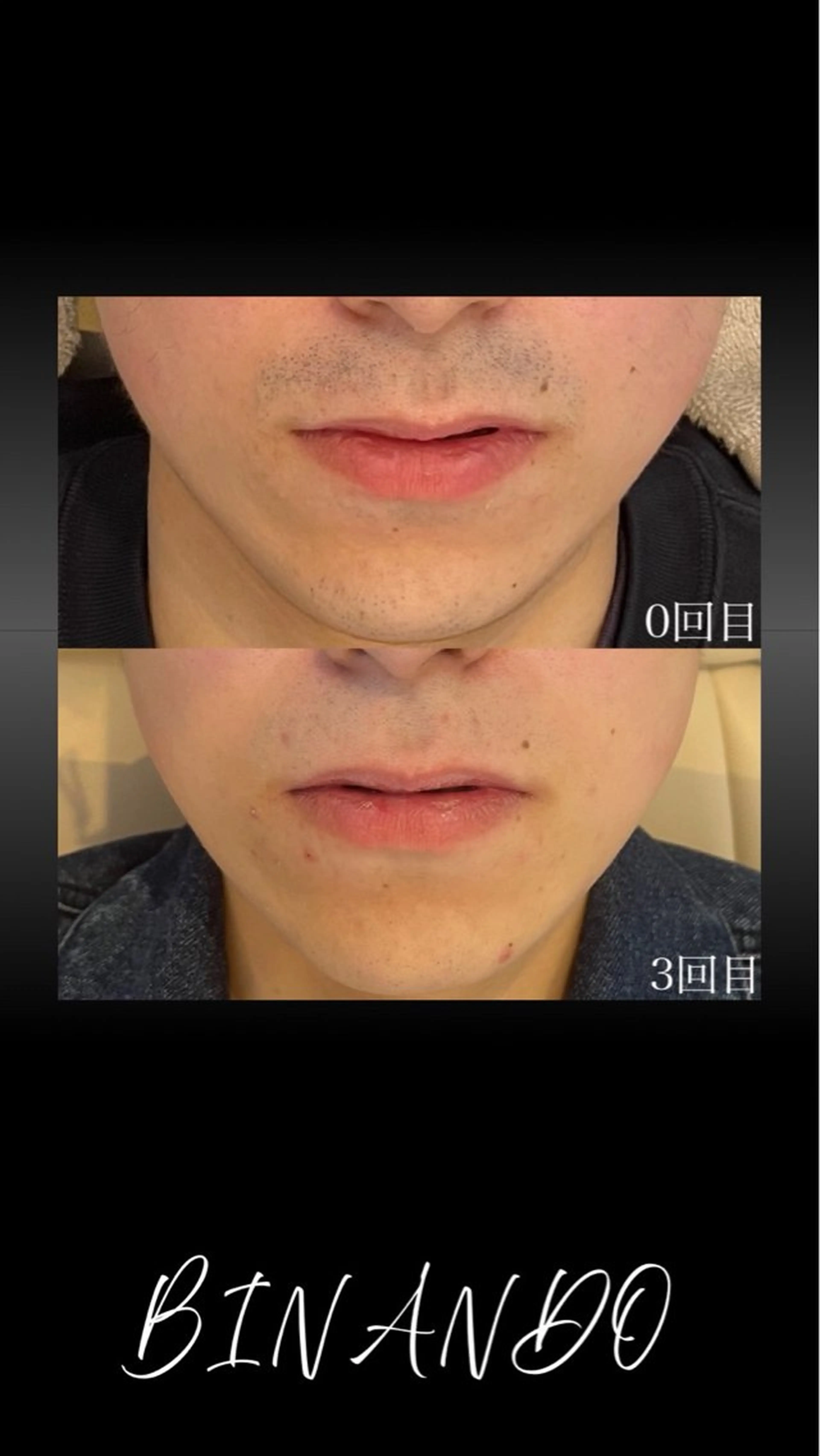 メンズ BINANDO 増田の眉毛・アイブロウイメージ