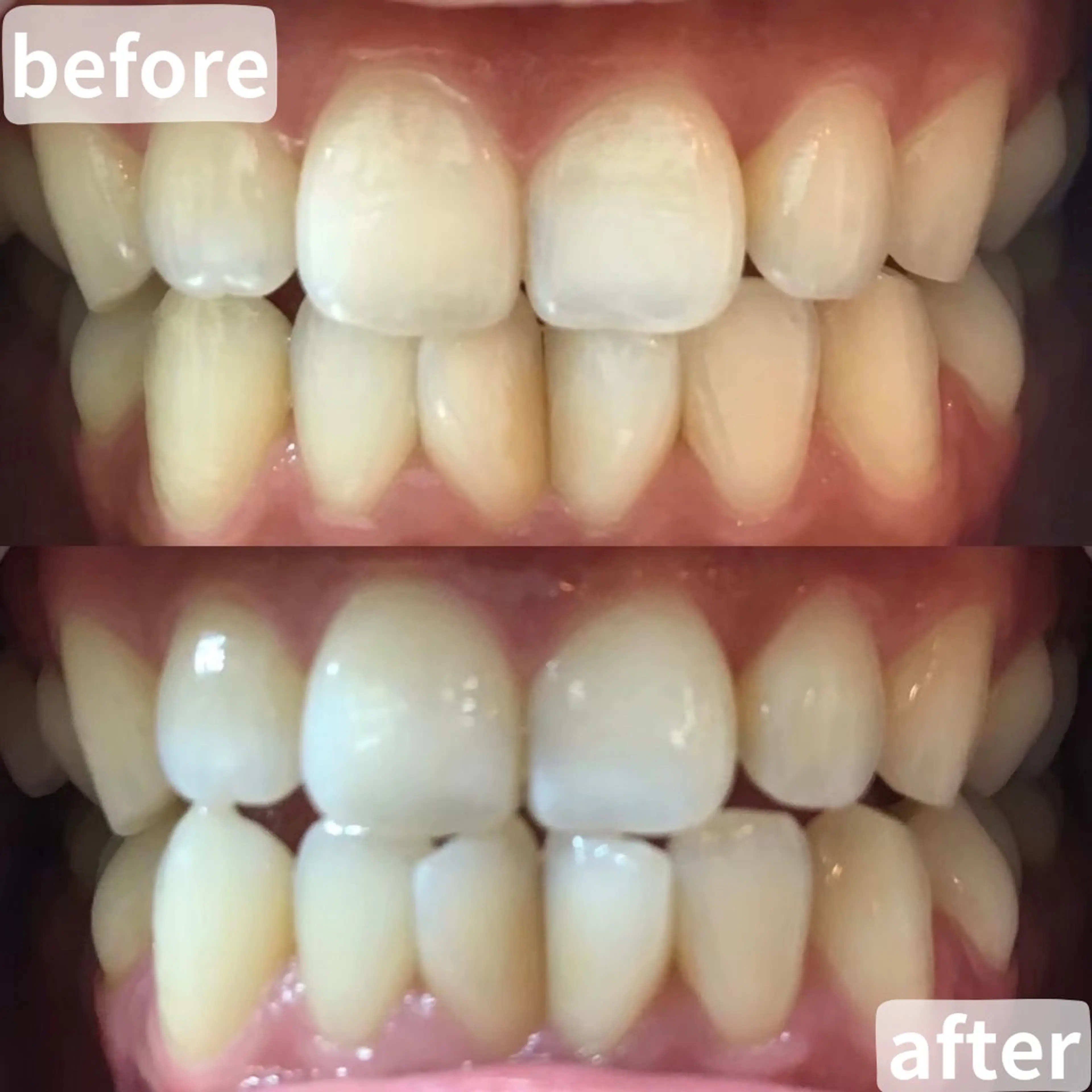 LBSホワイトニング桶川店所属・LBSホワイトニング 桶川店のエステ・リラクイメージ