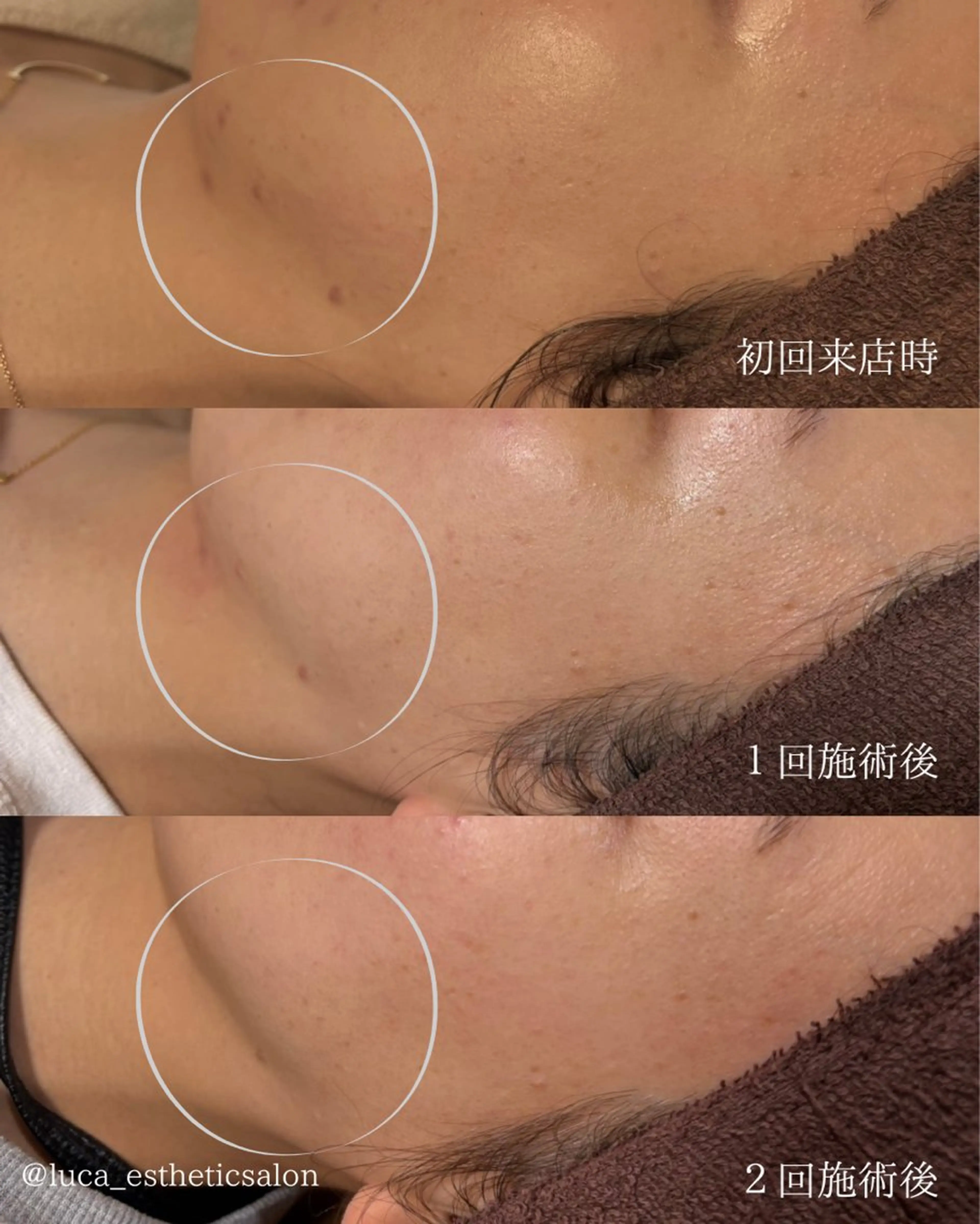 エステ Luca所属・Luca 痩身• 疲労改善×韓国肌管理のエステ・リラクイメージ