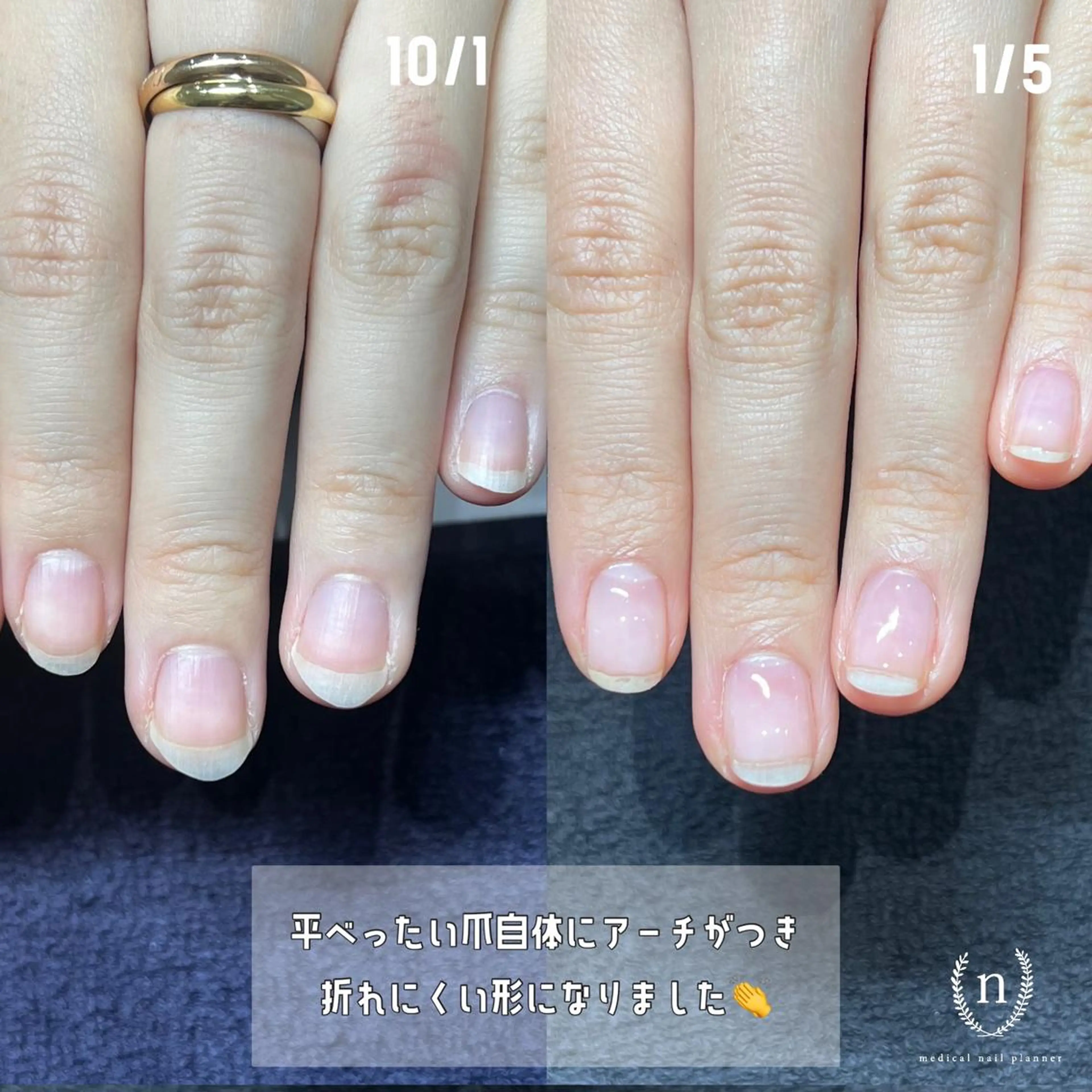 ネイル ハンドネイル 自爪育成専門サロン ◌𓈒azumiのネイルデザイン