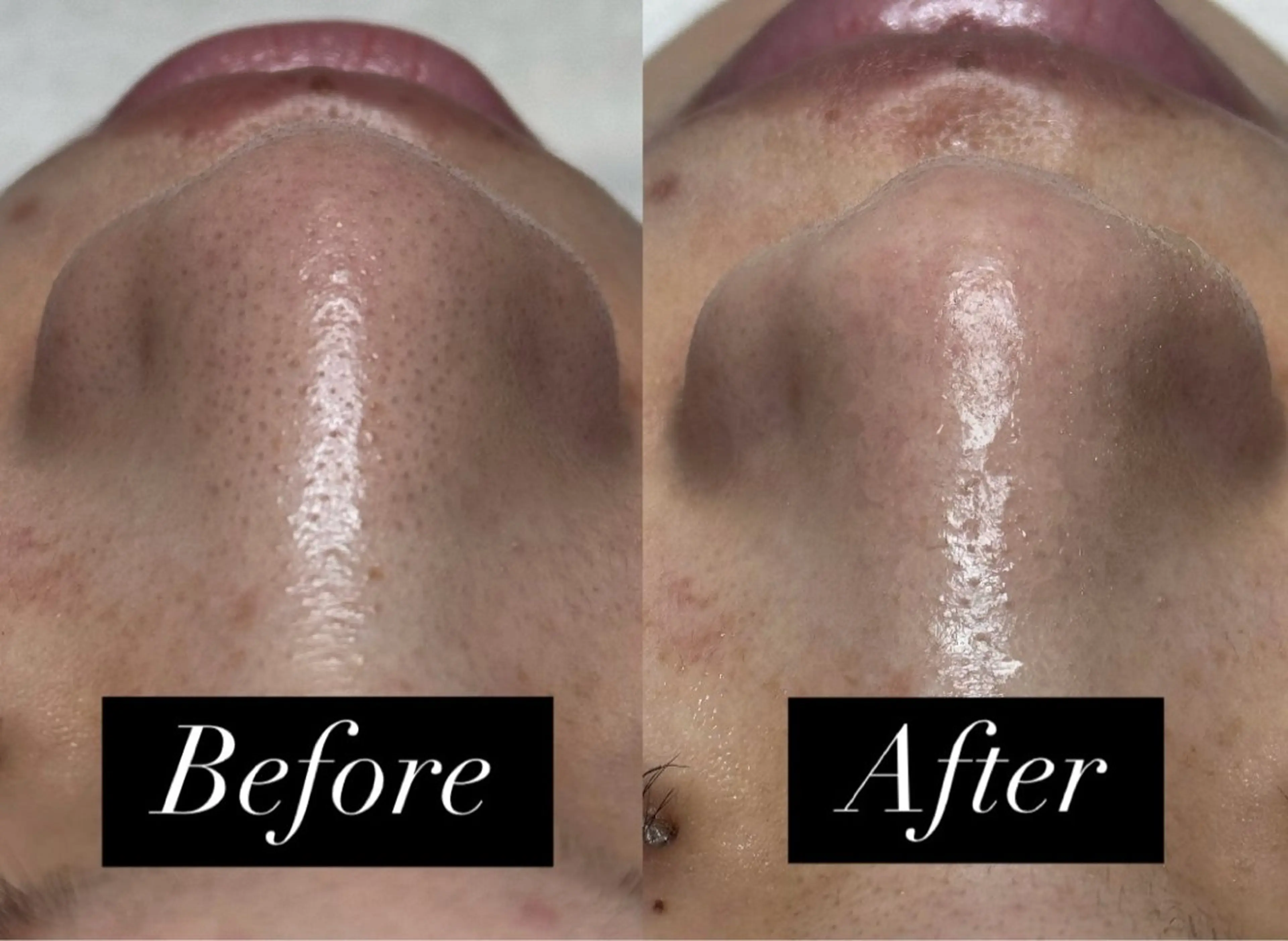 脱毛＆小顔コルギ 専門店 Lucirのエステ・リラクイメージ