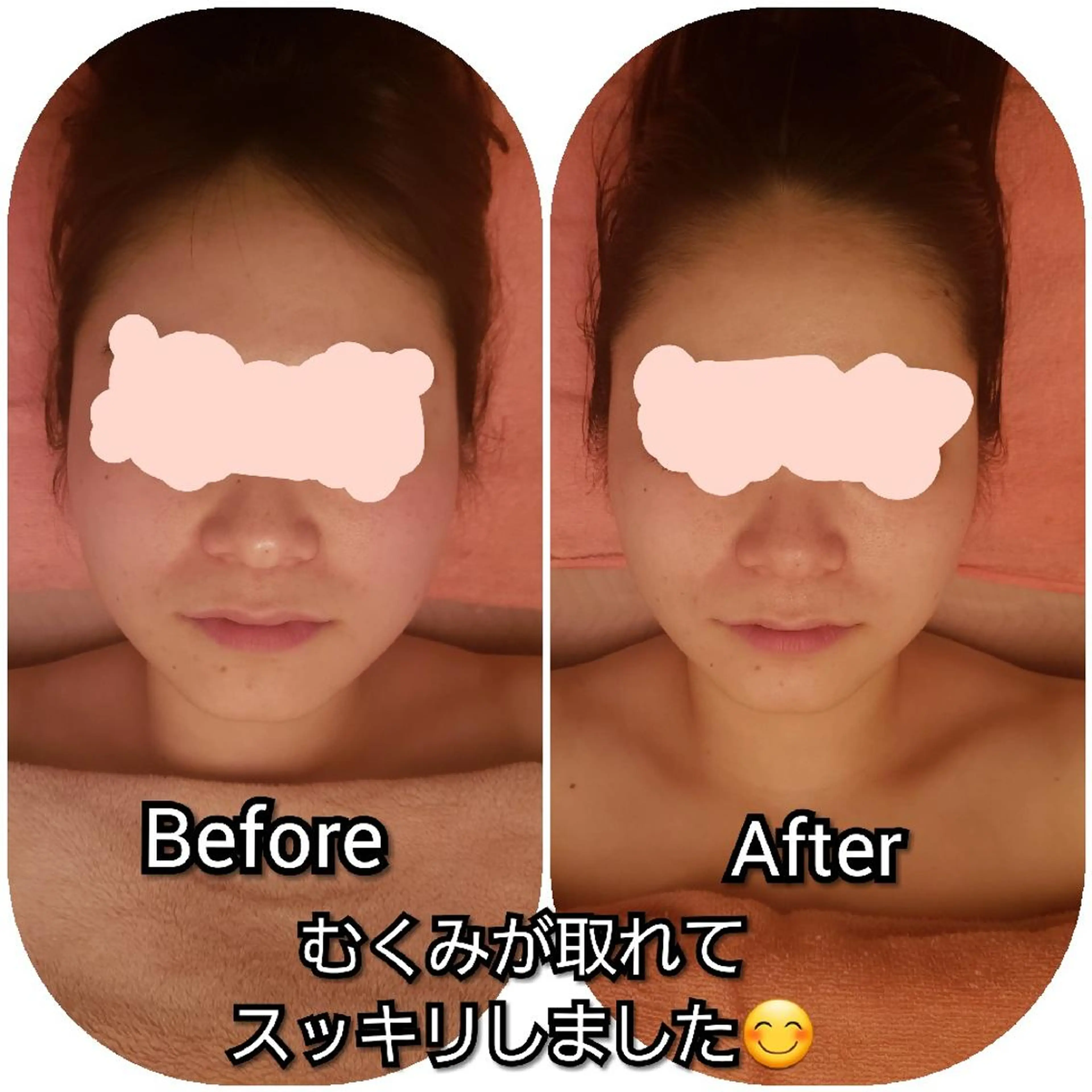 毛穴ケア くすみ肌 ハーブピーリングのエステ・リラクイメージ