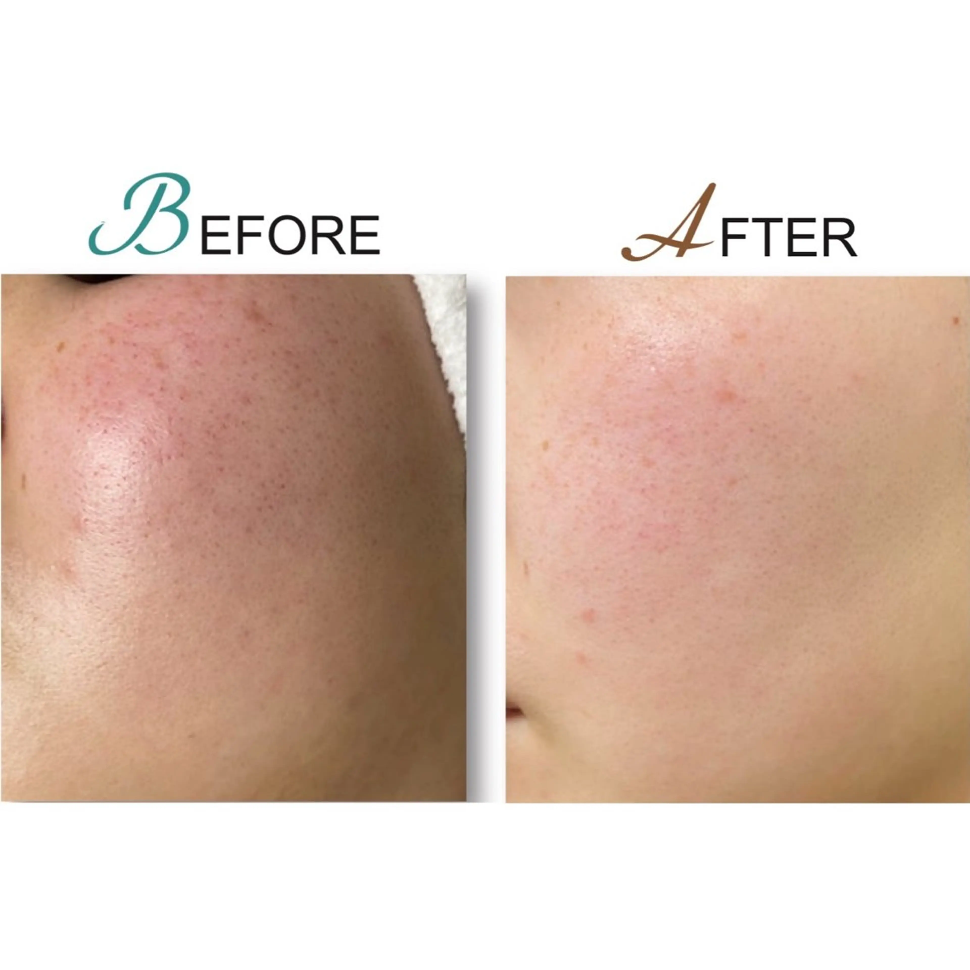 脱毛・美肌サロン LILIAN 脱石油のエステ・リラクイメージ