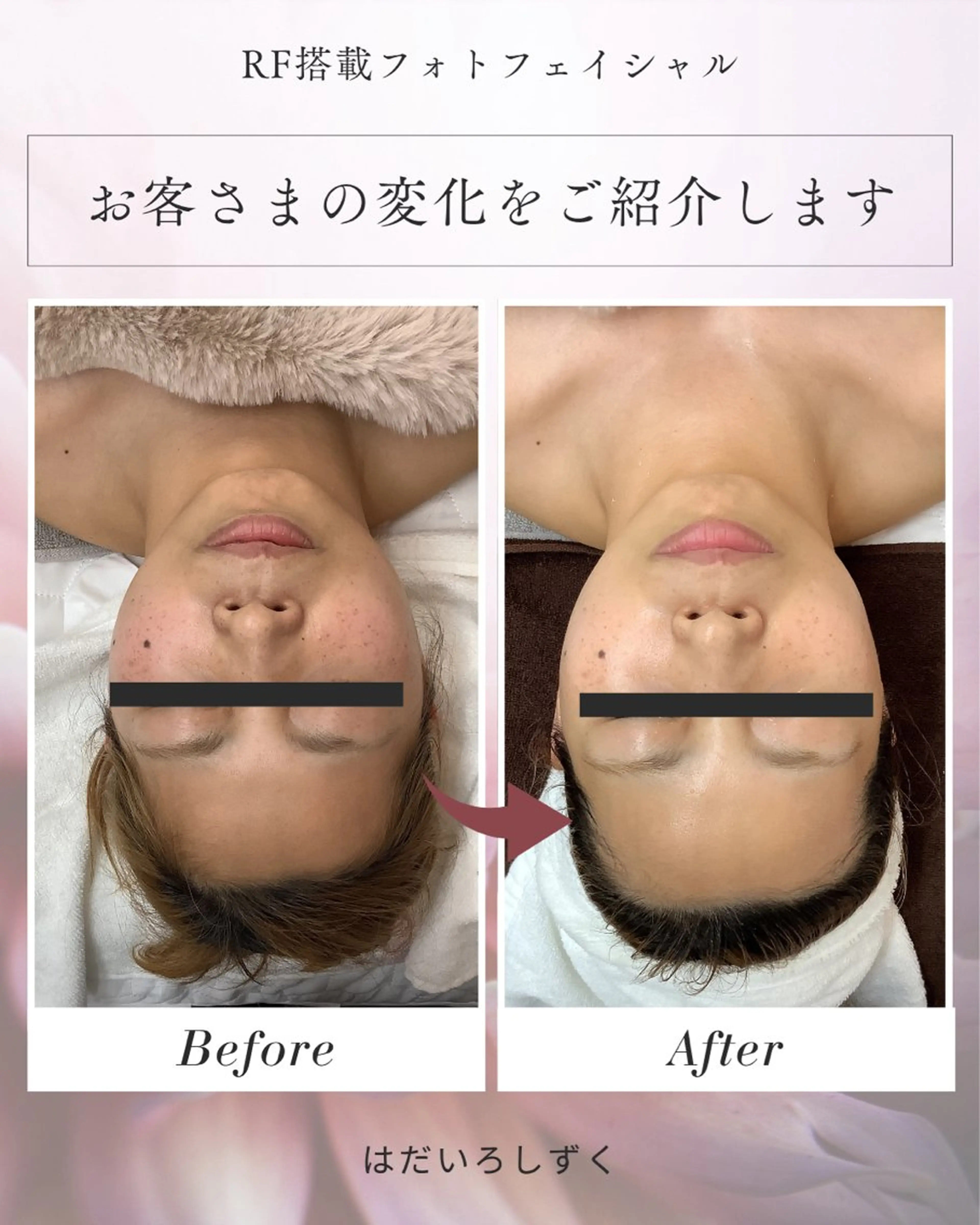 エステ はだいろしずく 四家のエステ・リラクイメージ