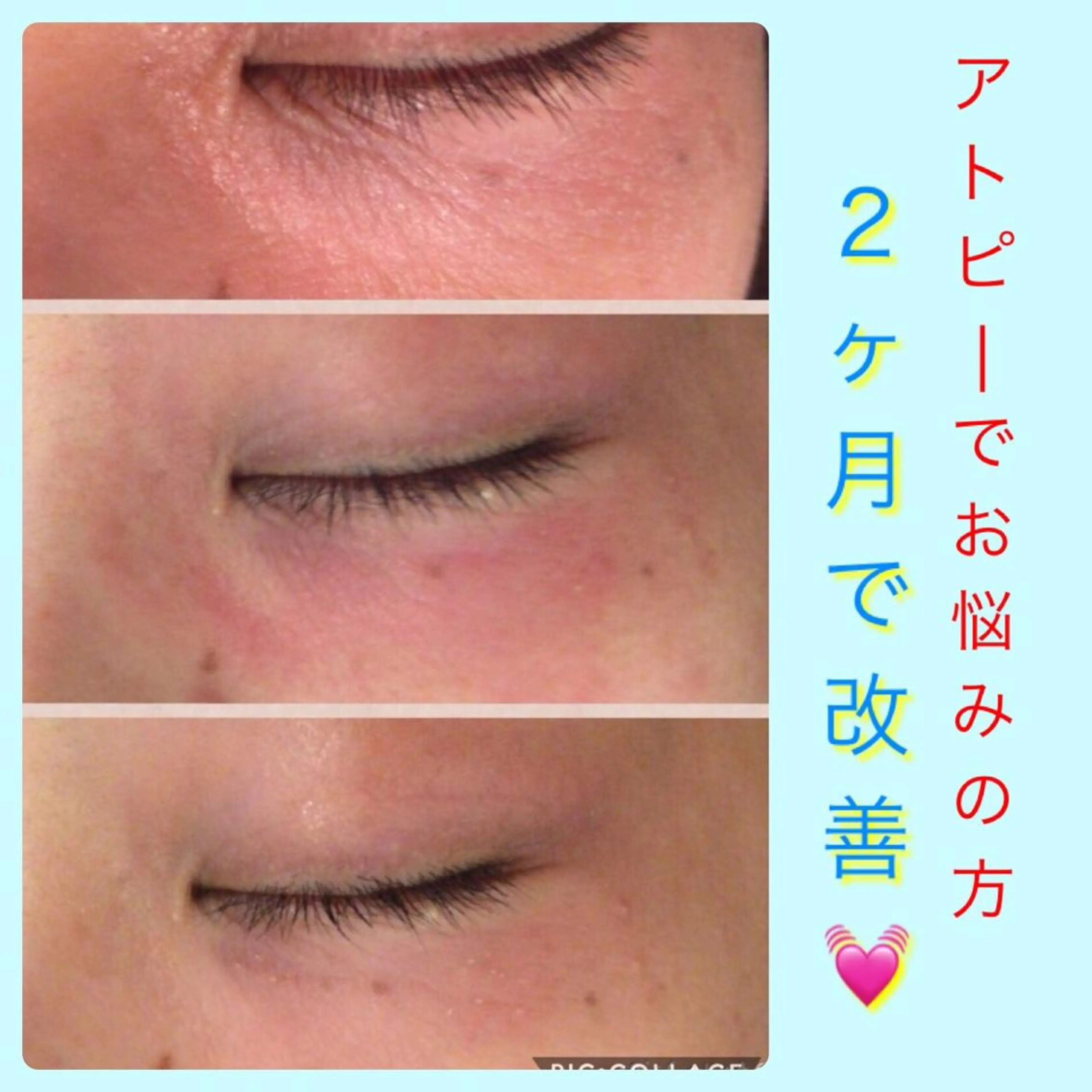 ミディアム カラー パーマ ヘアアレンジ メンズ キッズ ネイル マツエク・マツパ エステ リラク ニキビ・肌質改善専門 ♡人生が変わるサロンのエステ・リラクイメージ