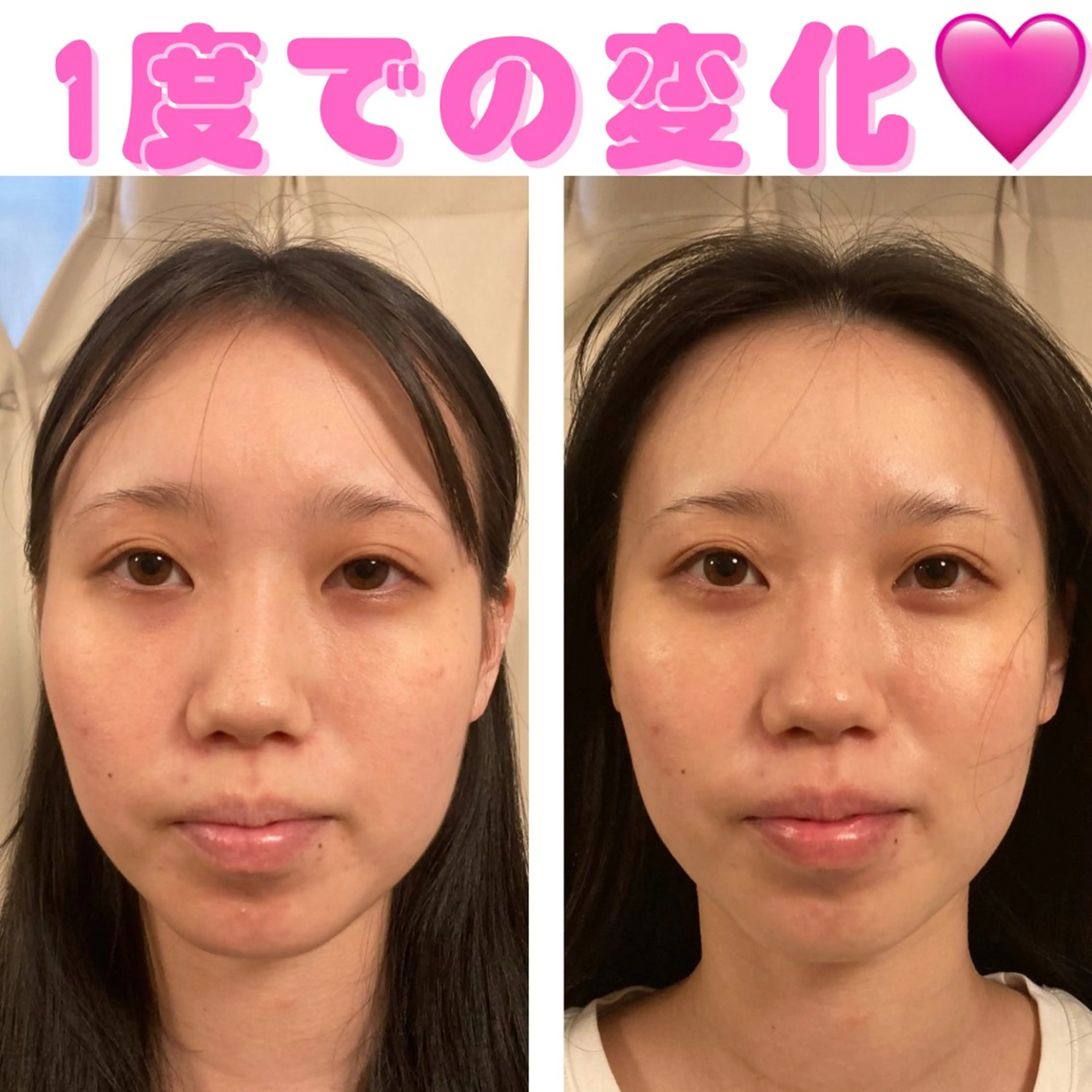 ポテンツァ&針美容 バストアップ専門店のエステ・リラクイメージ