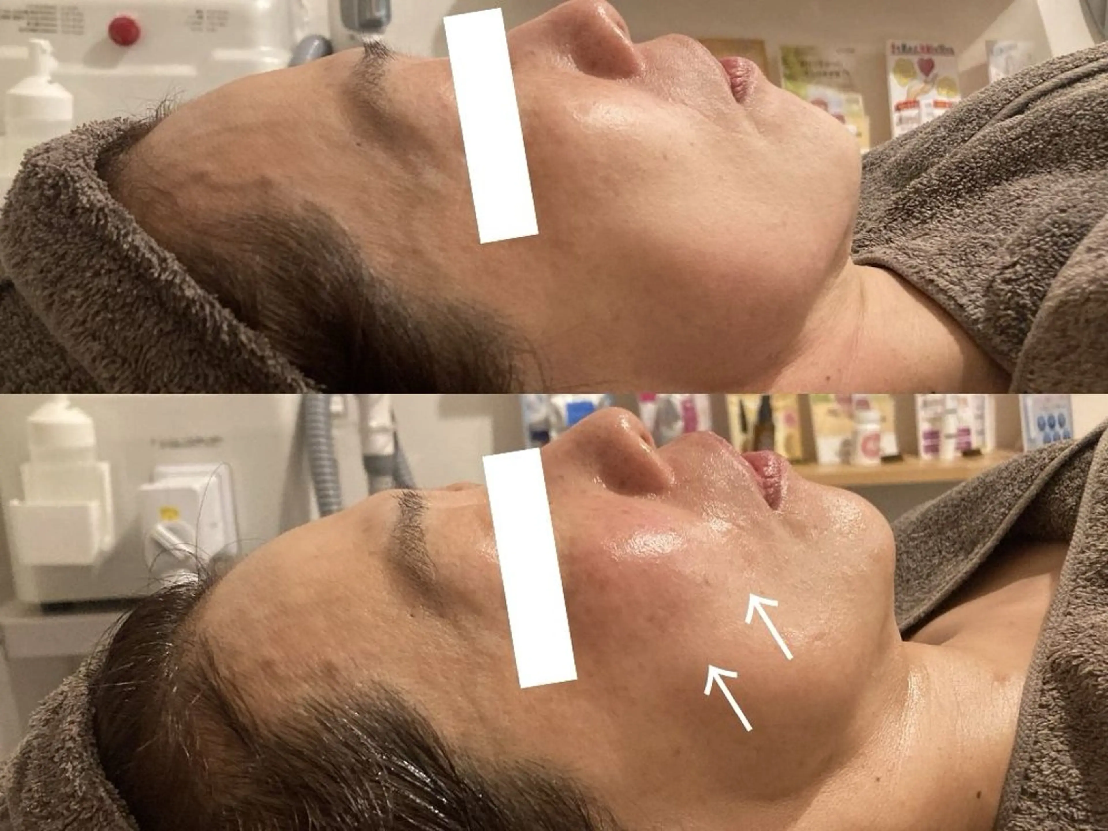 【年齢肌】年齢肌立て直すトータル集中ケアコースの写真