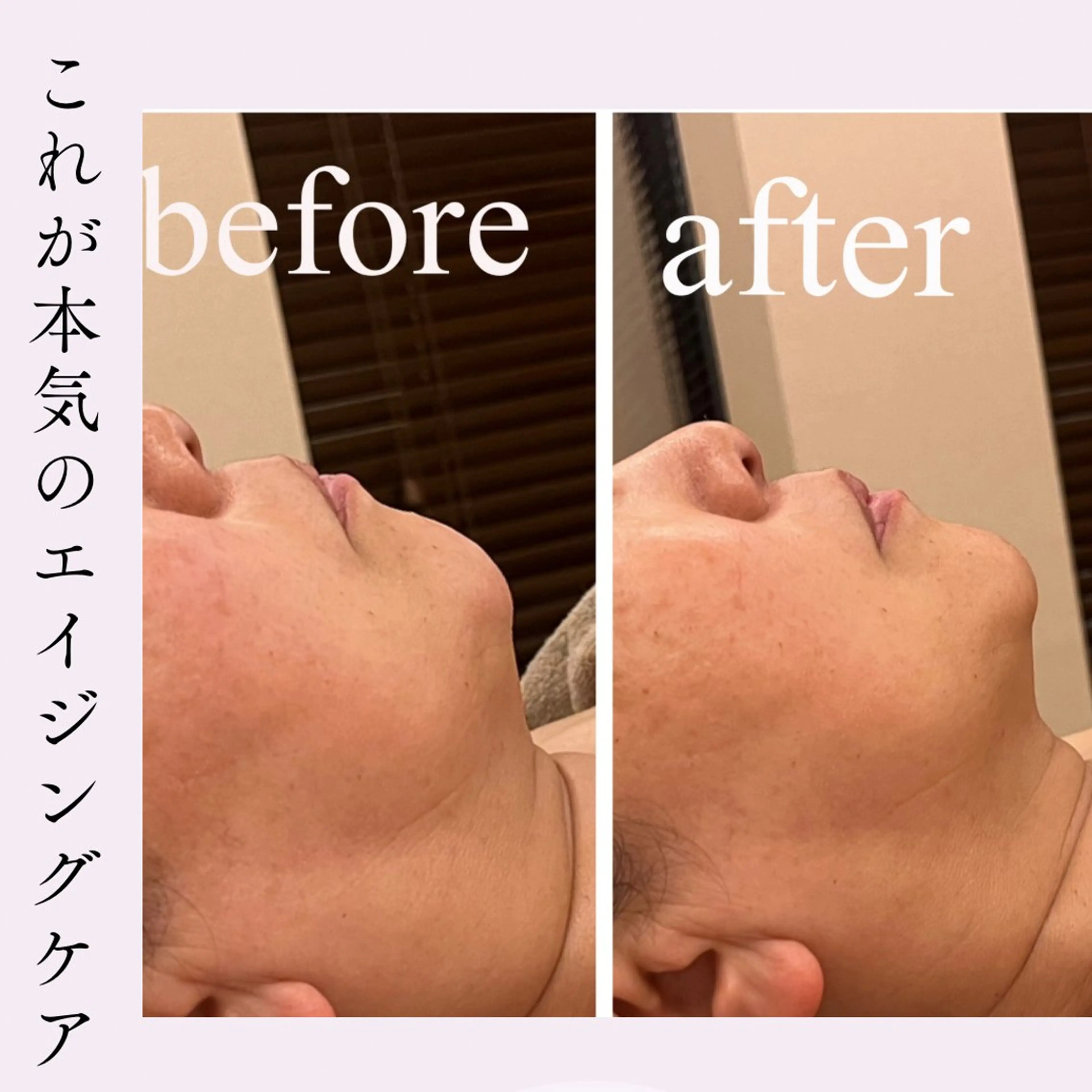 小顔・リフトアップ/ 奈緒美のエステ・リラクイメージ