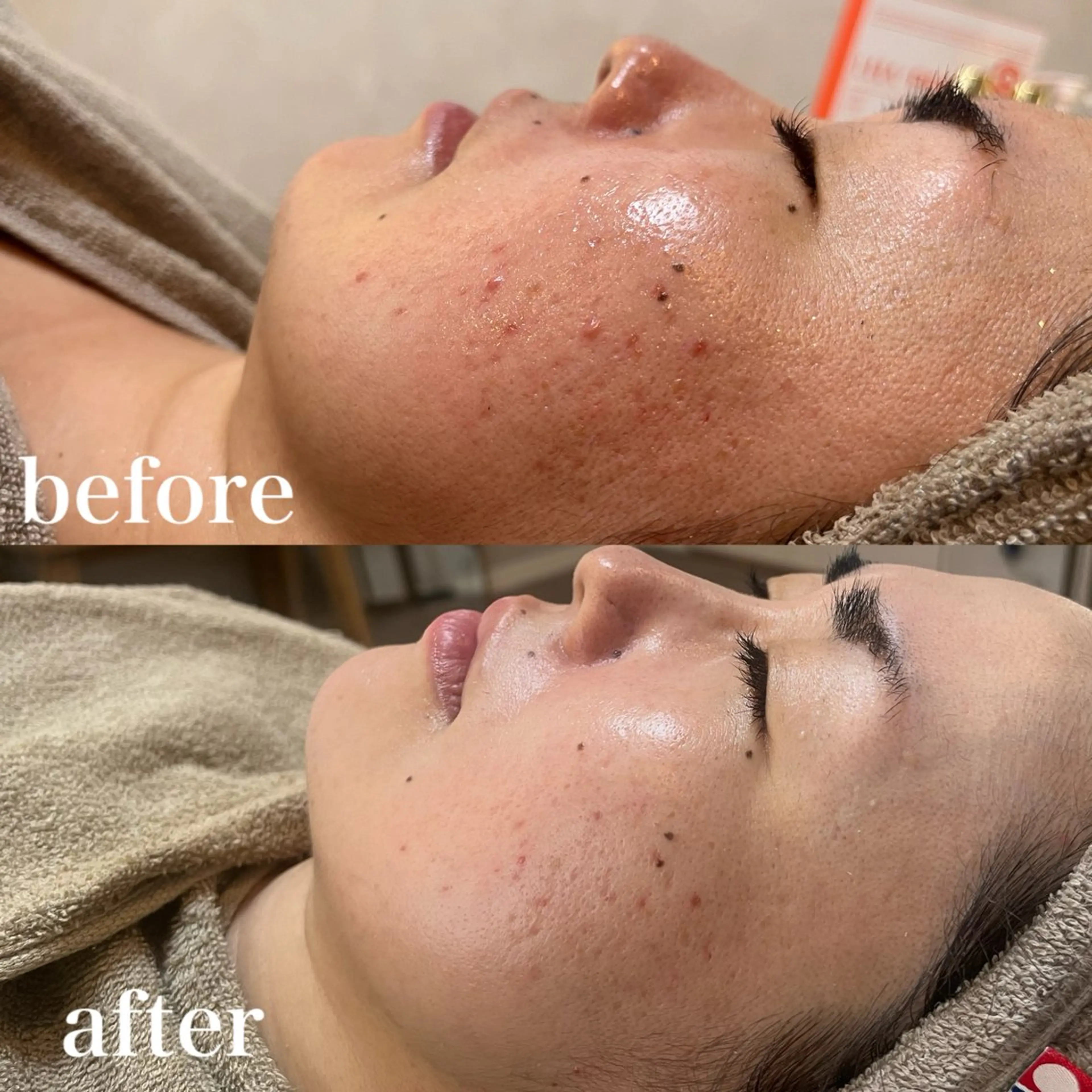 unsui spa 渋谷区神泉のエステ・リラクイメージ