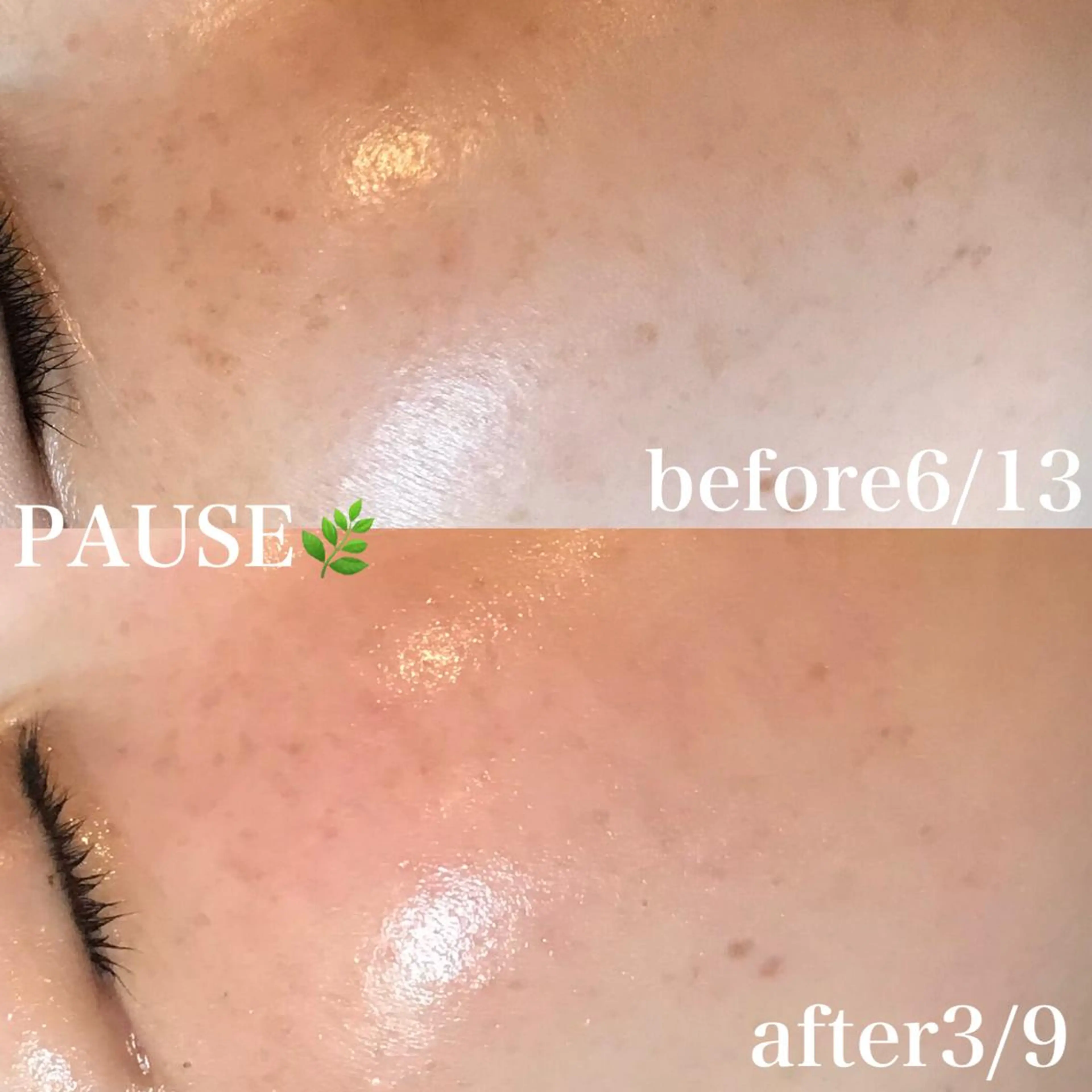 エステ 浜野 恵美のエステ・リラクイメージ