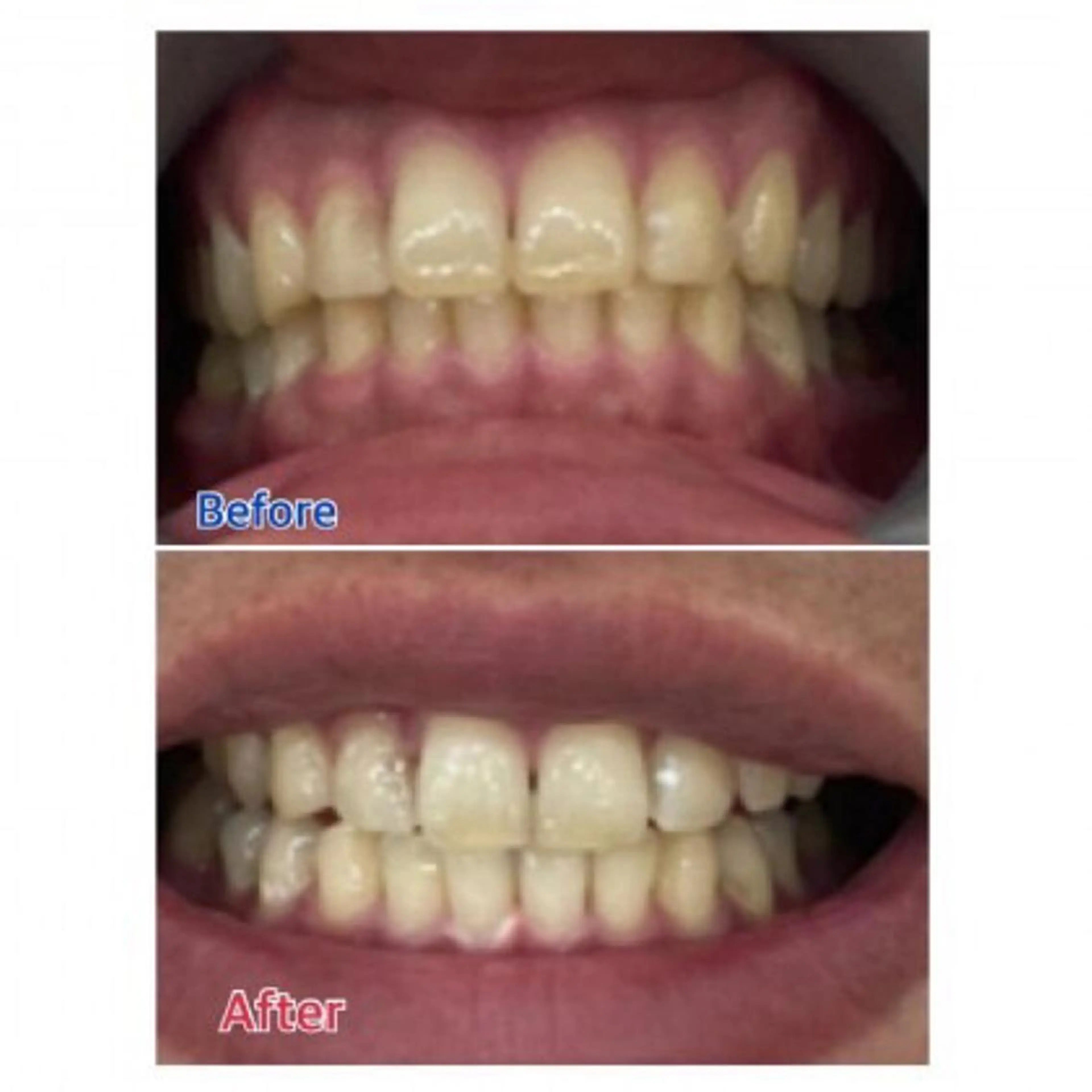 Ｍ渋谷 ホワイトニングのエステ・リラクイメージ