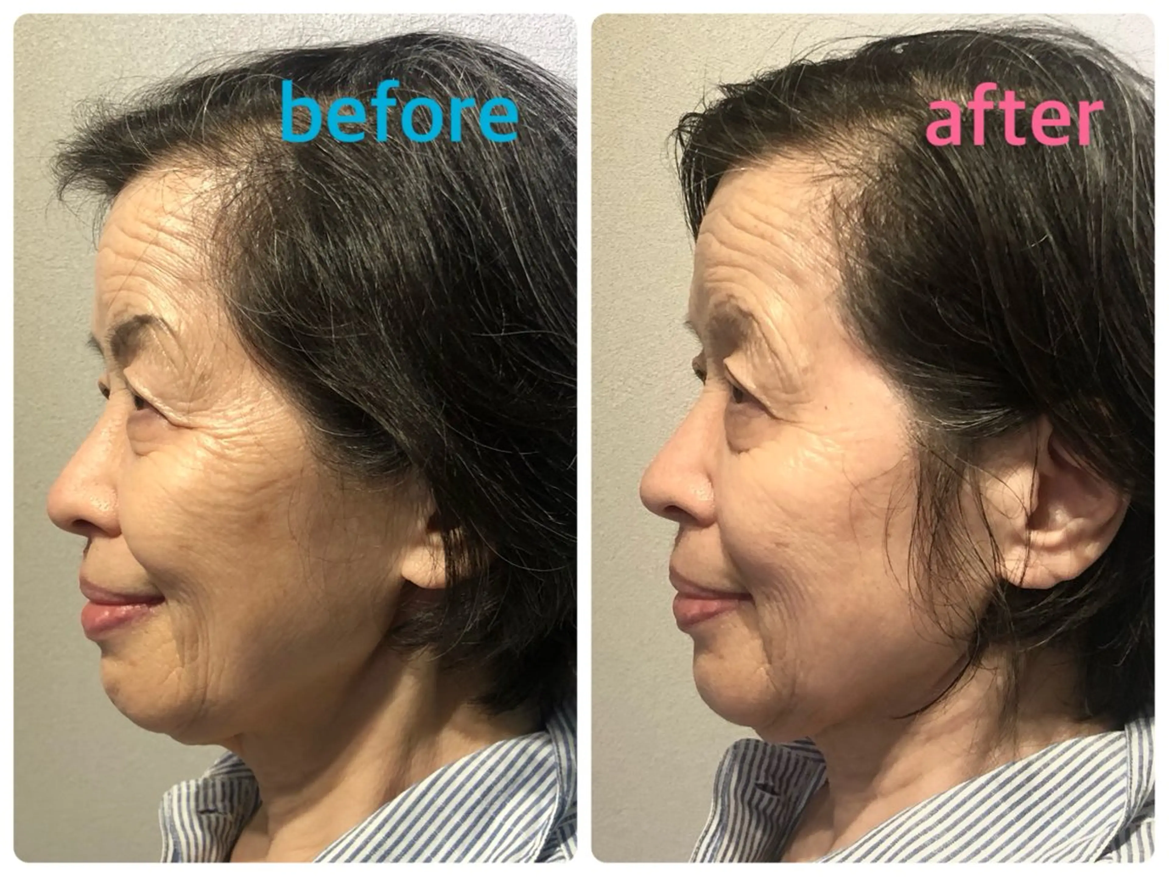 安眠ヘッドスパ整体 🌿白金/目黒/鈴木のエステ・リラクイメージ