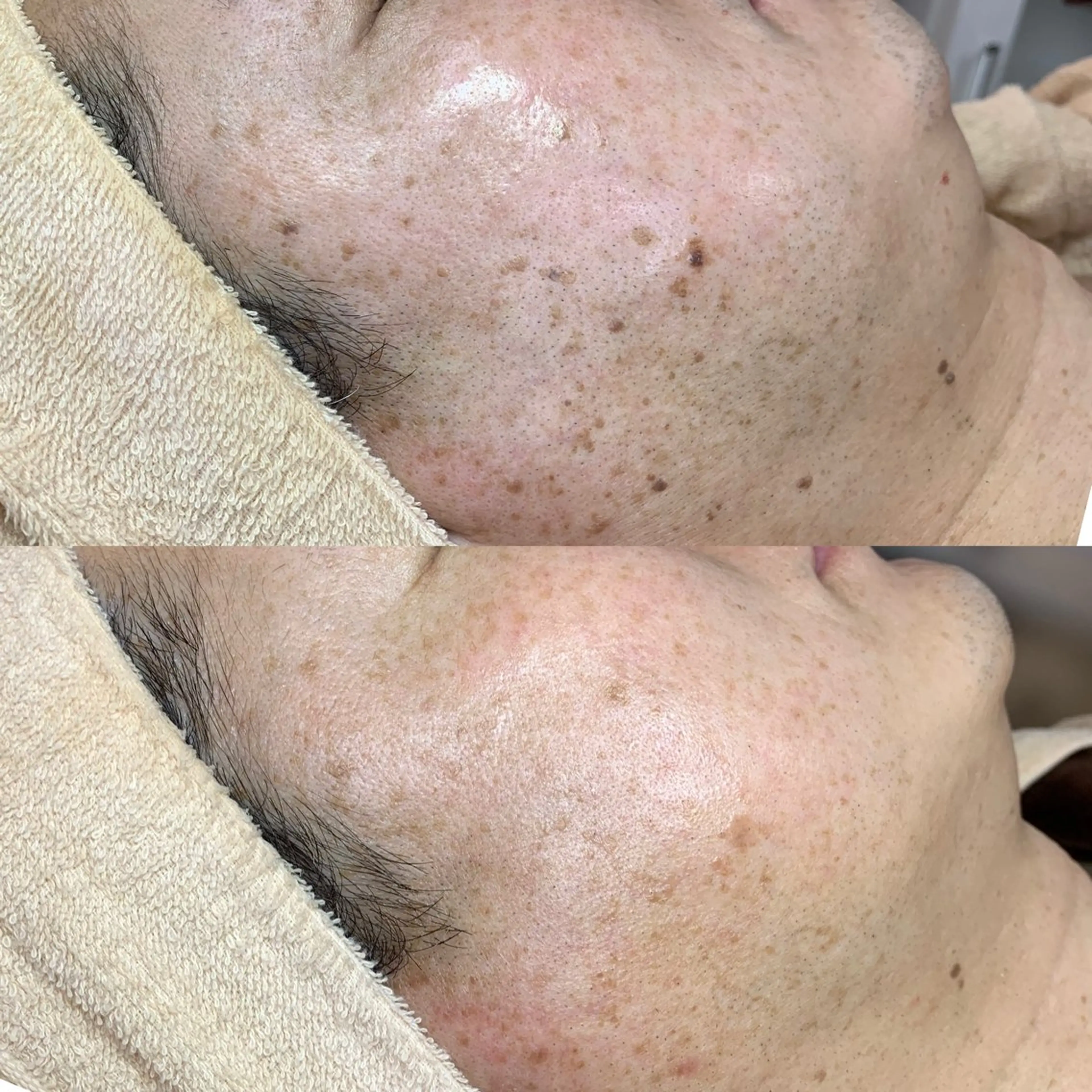 エステ シミケア専門サロン 10POINT.Kのエステ・リラクイメージ