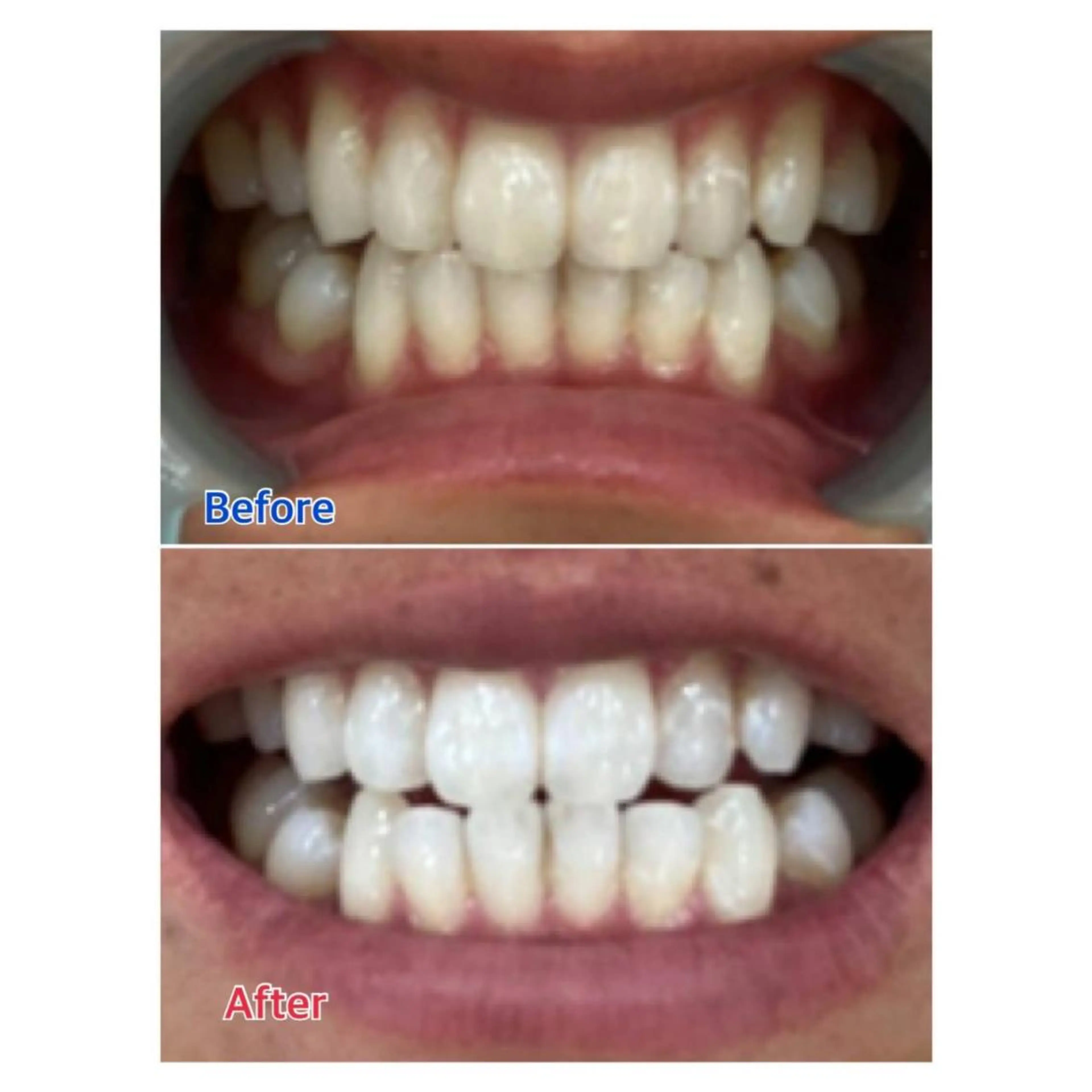 Melty 輝のその他イメージ