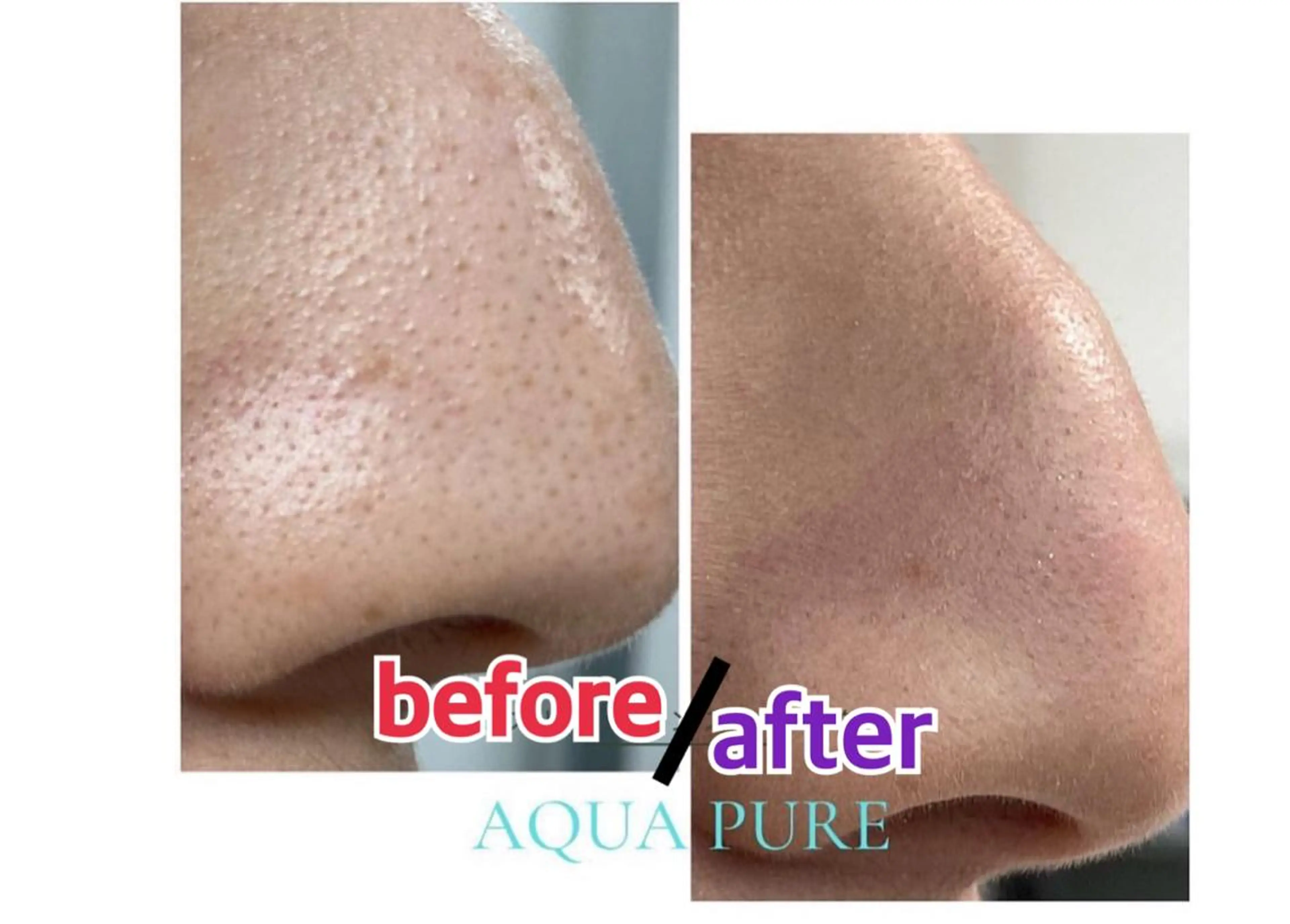 小顔・ツルツル素肌 ハリステリアのエステ・リラクイメージ