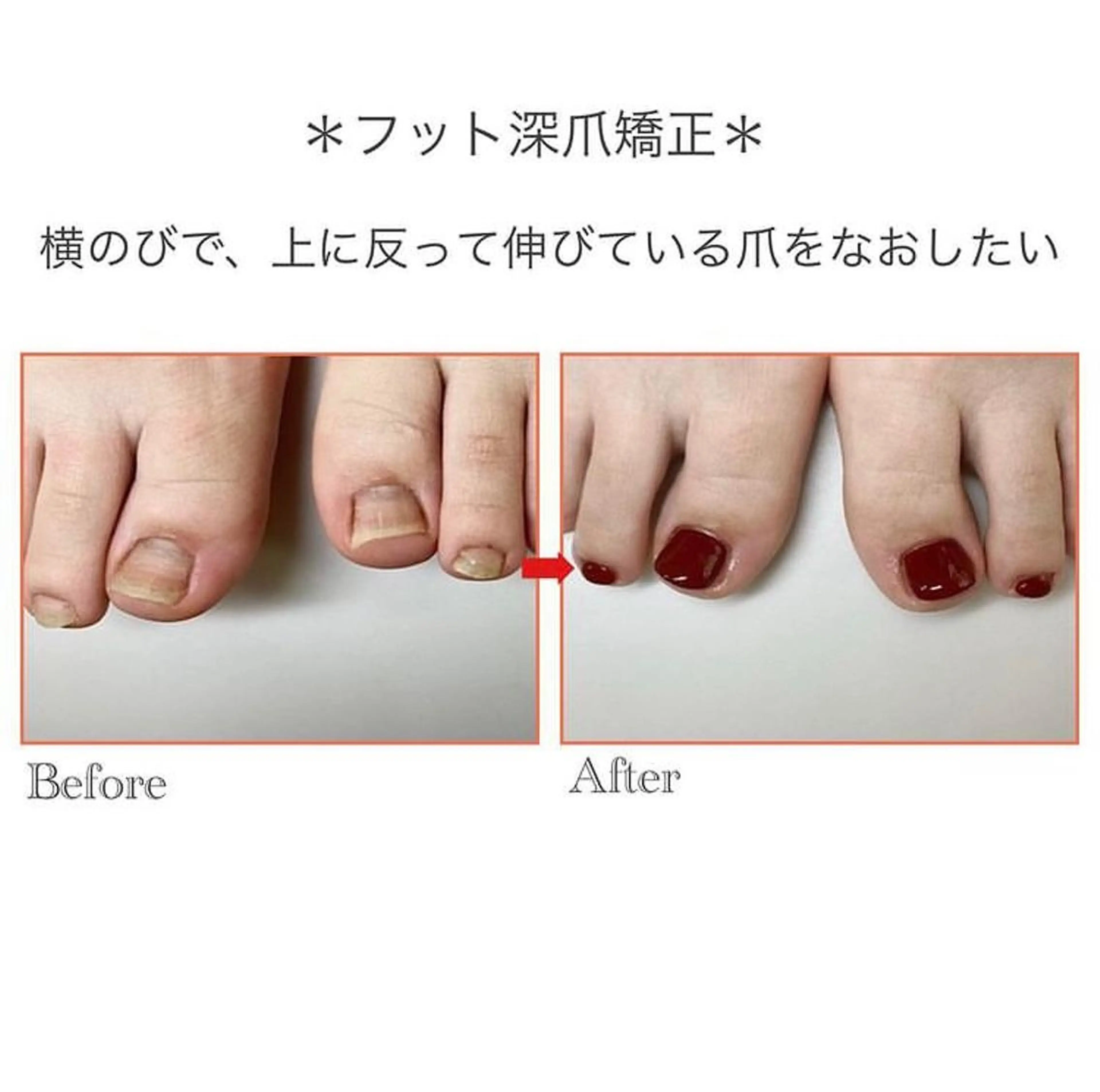 ネイル フットネイル ネイルサロンアリューム所属・ネイルサロン アリュームのネイルデザイン