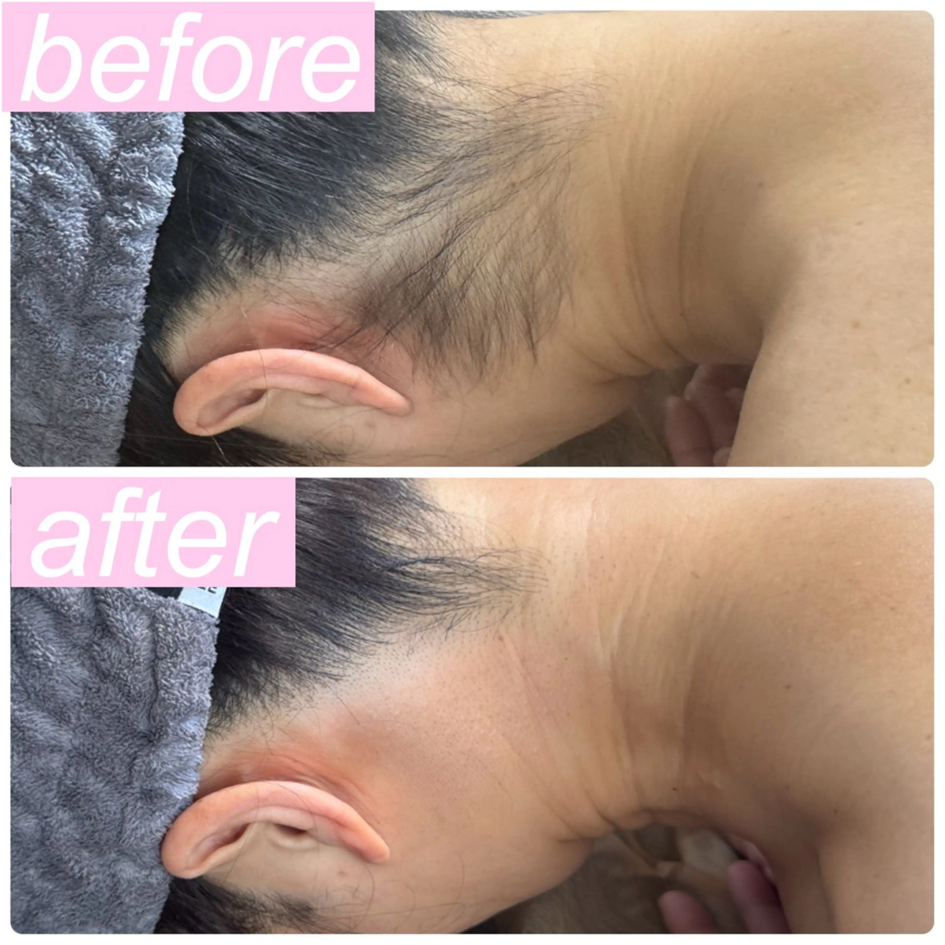 脱毛 肌育脱毛サロン LikoLinaのその他イメージ