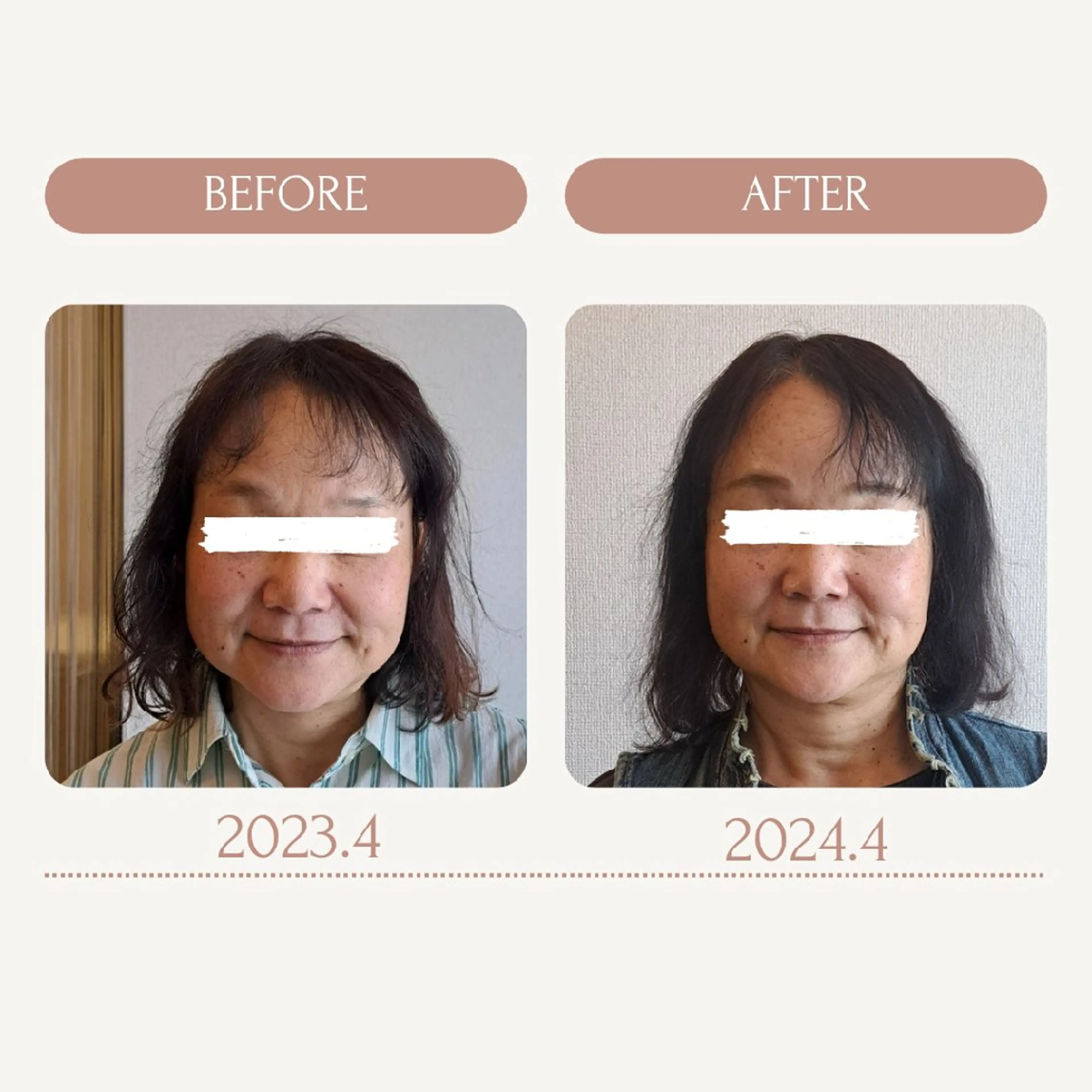 エステ リラク 鍼灸サロンmiyabi所属・美容鍼×エステ 鍼灸 サロンmiyabiのエステ・リラクイメージ