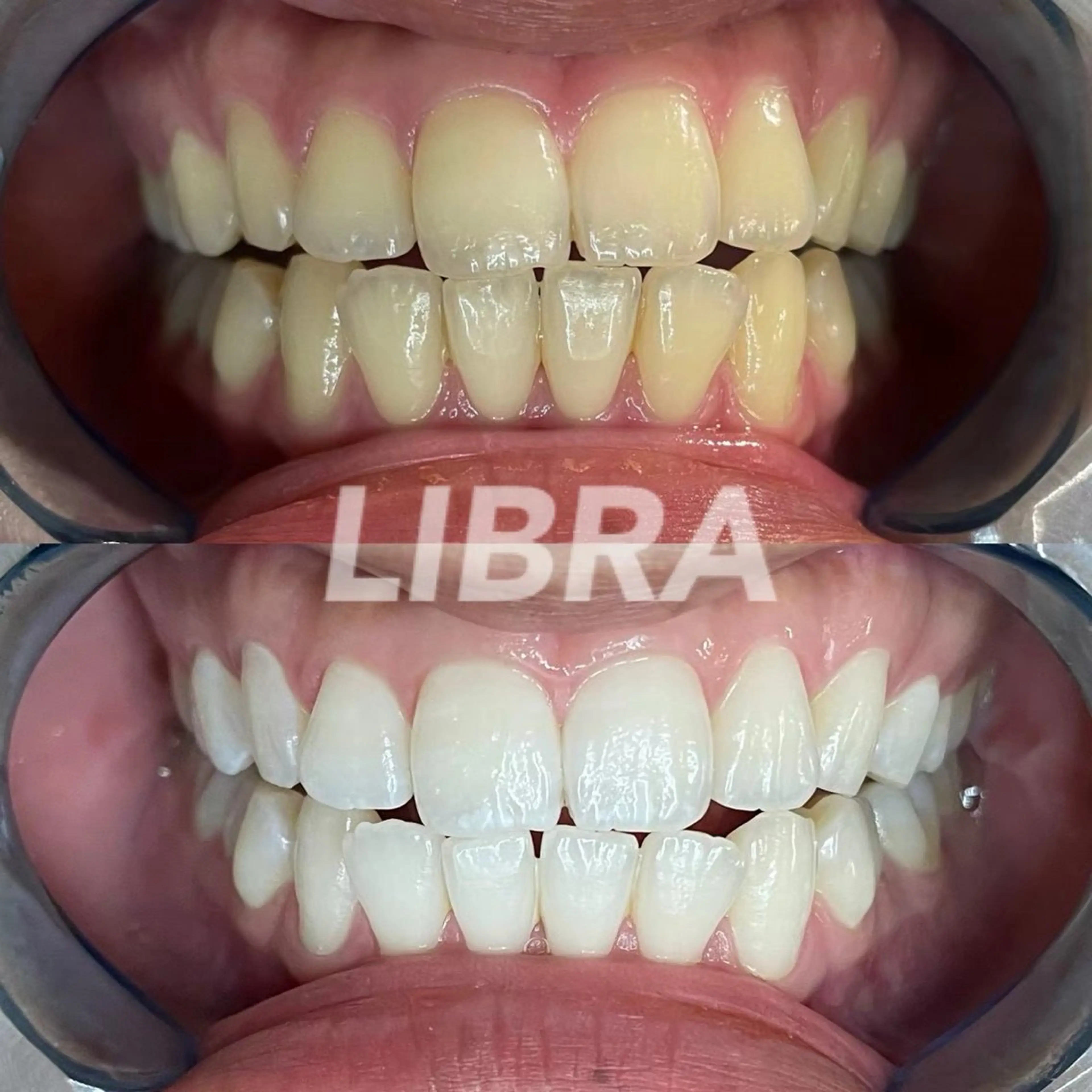 LIBRA心斎橋 セルフホワイトニングのその他イメージ