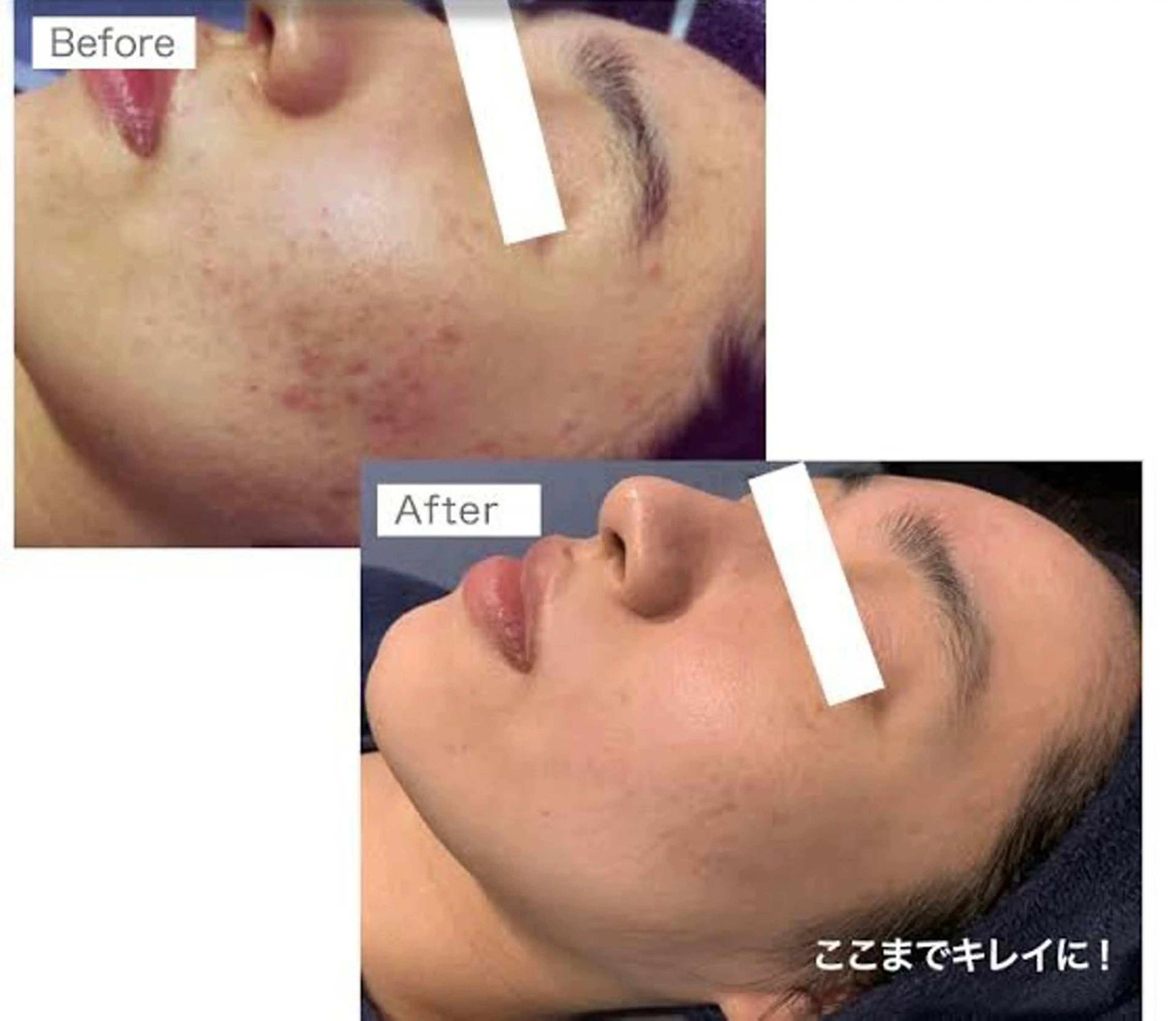 メンズ beauty salon  epのエステ・リラクイメージ