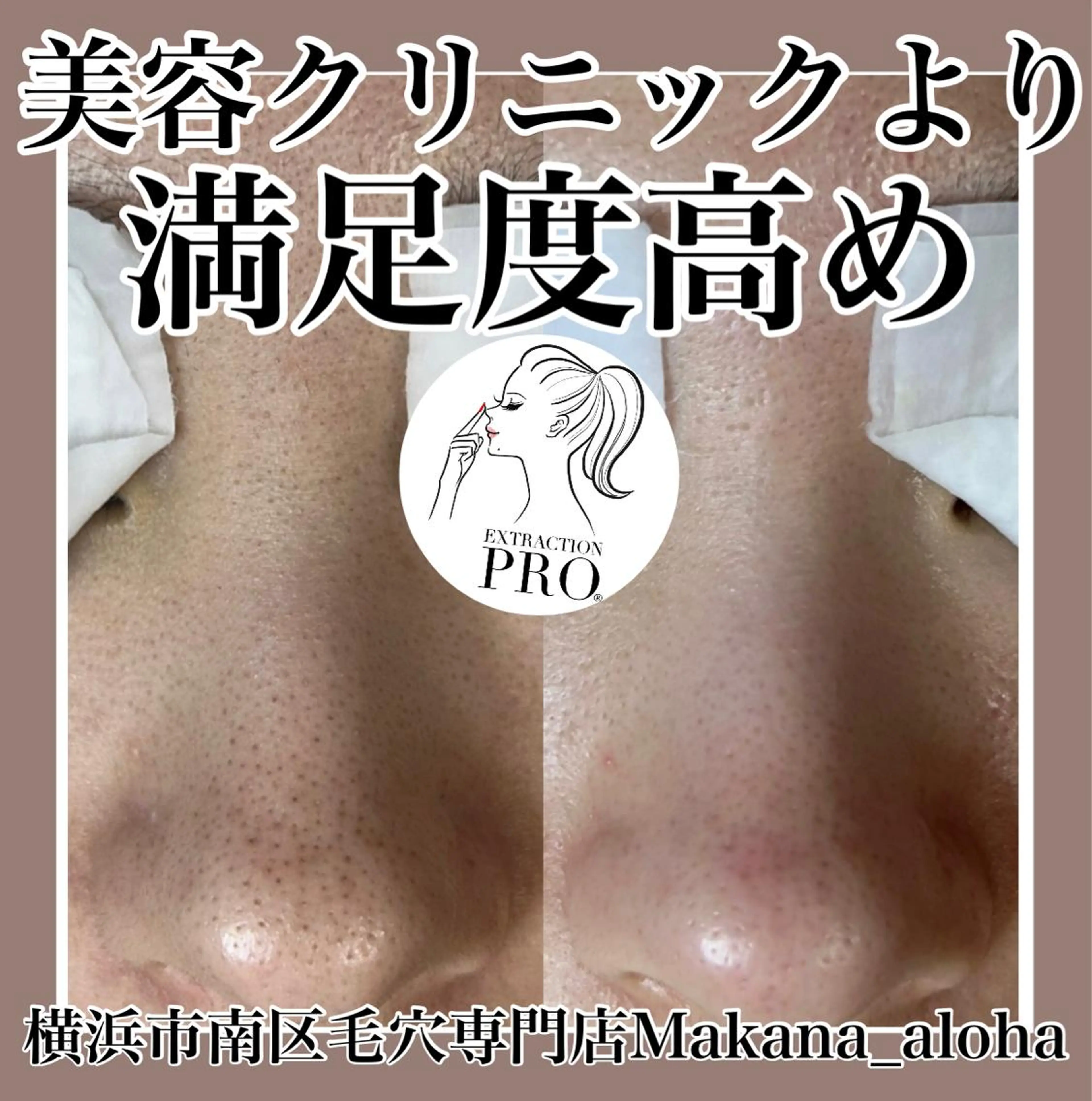 毛穴専門店 マカナアロハのエステ・リラクイメージ