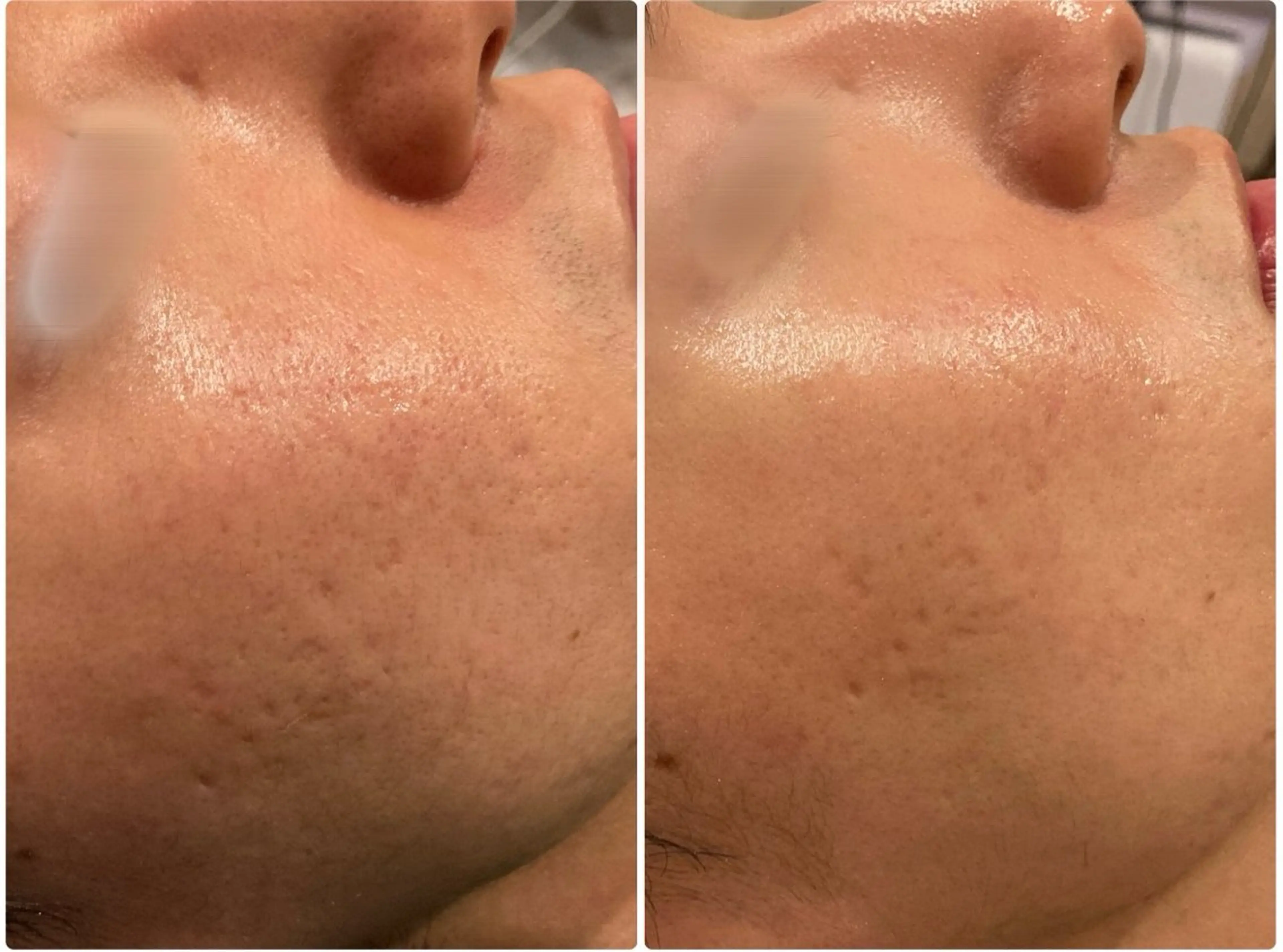 エステ 看護師が施術する美容 ナスサロ/石橋のエステ・リラクイメージ