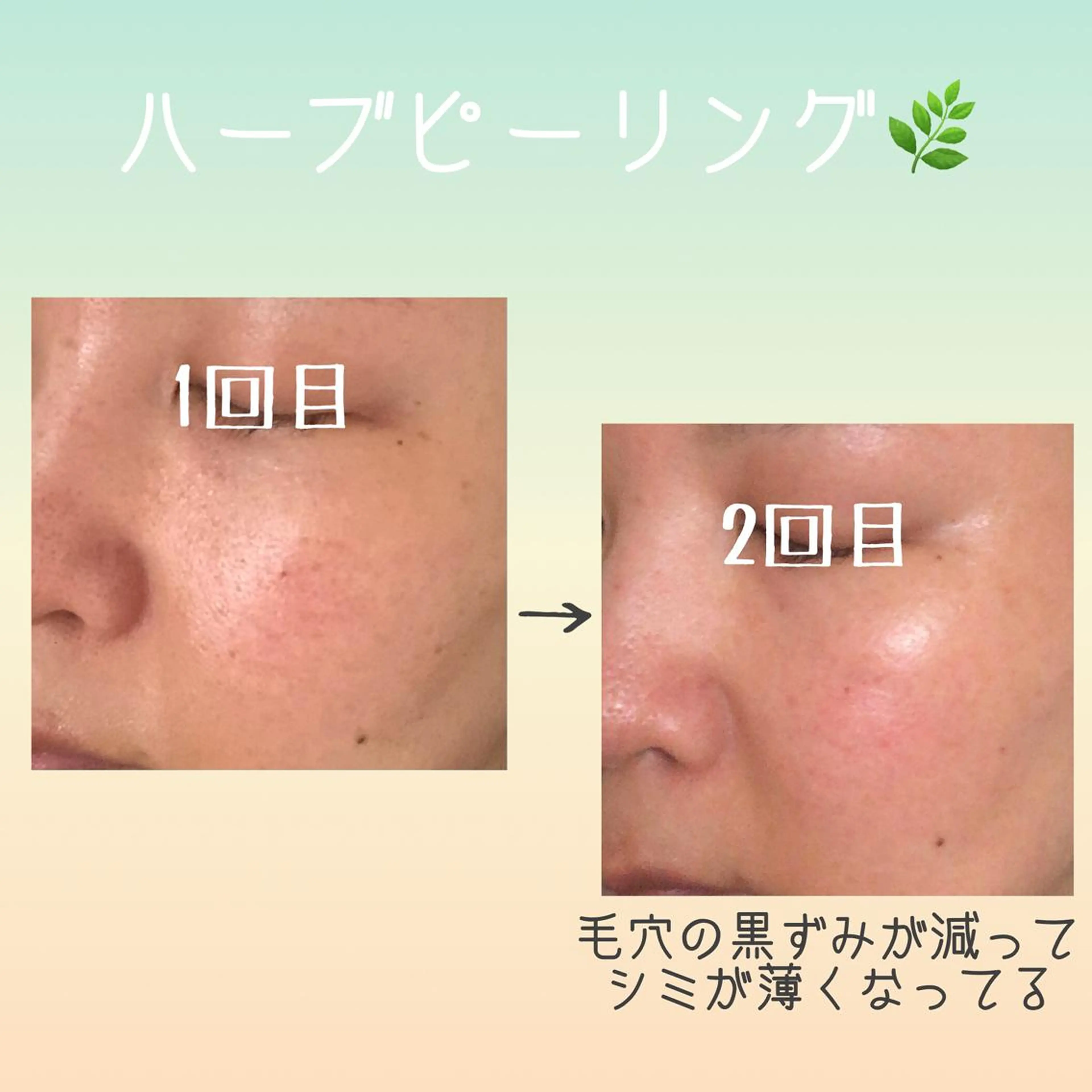 エステ リラク 心と華 まさきのエステ・リラクイメージ