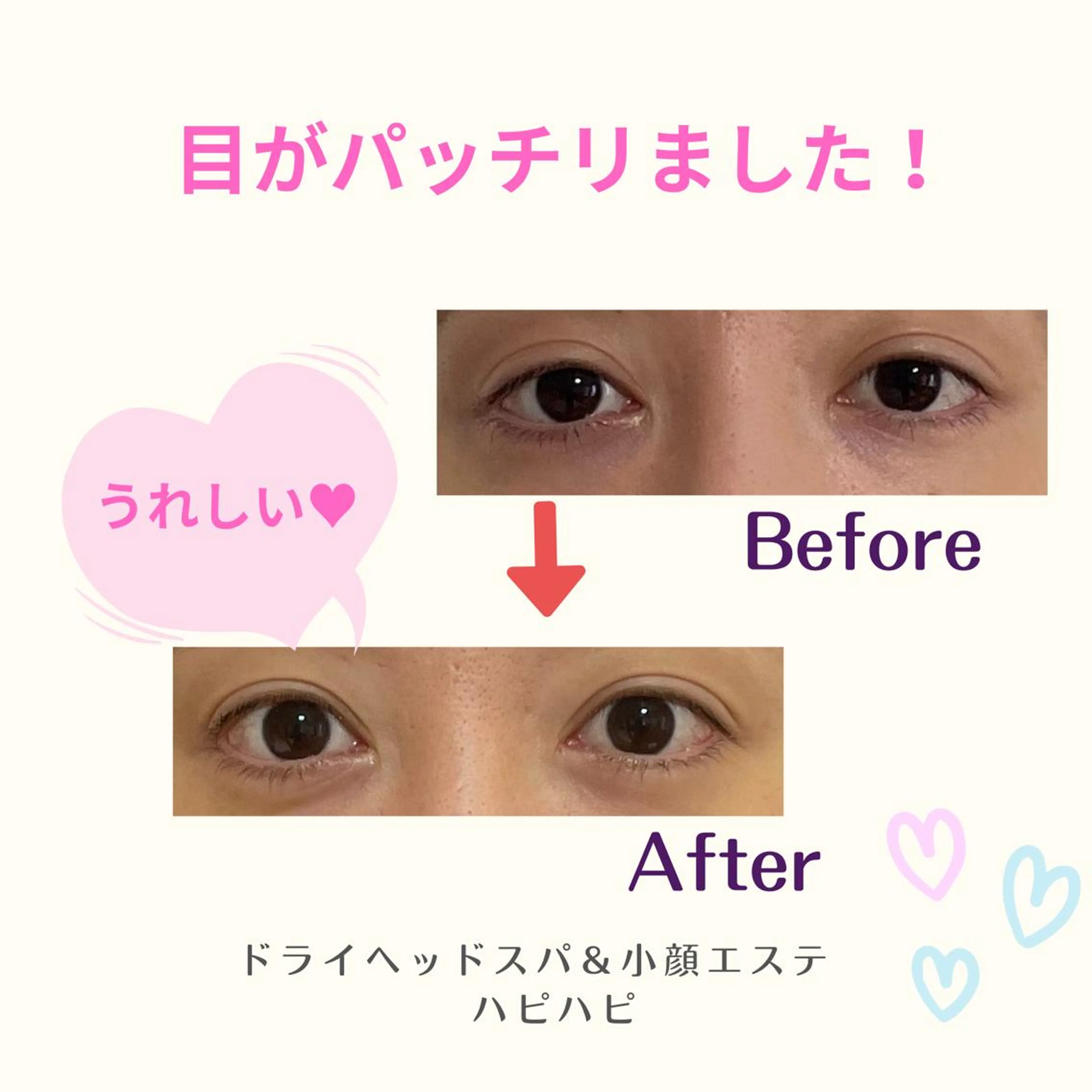 小顔エステサロン ハピハピのエステ・リラクイメージ