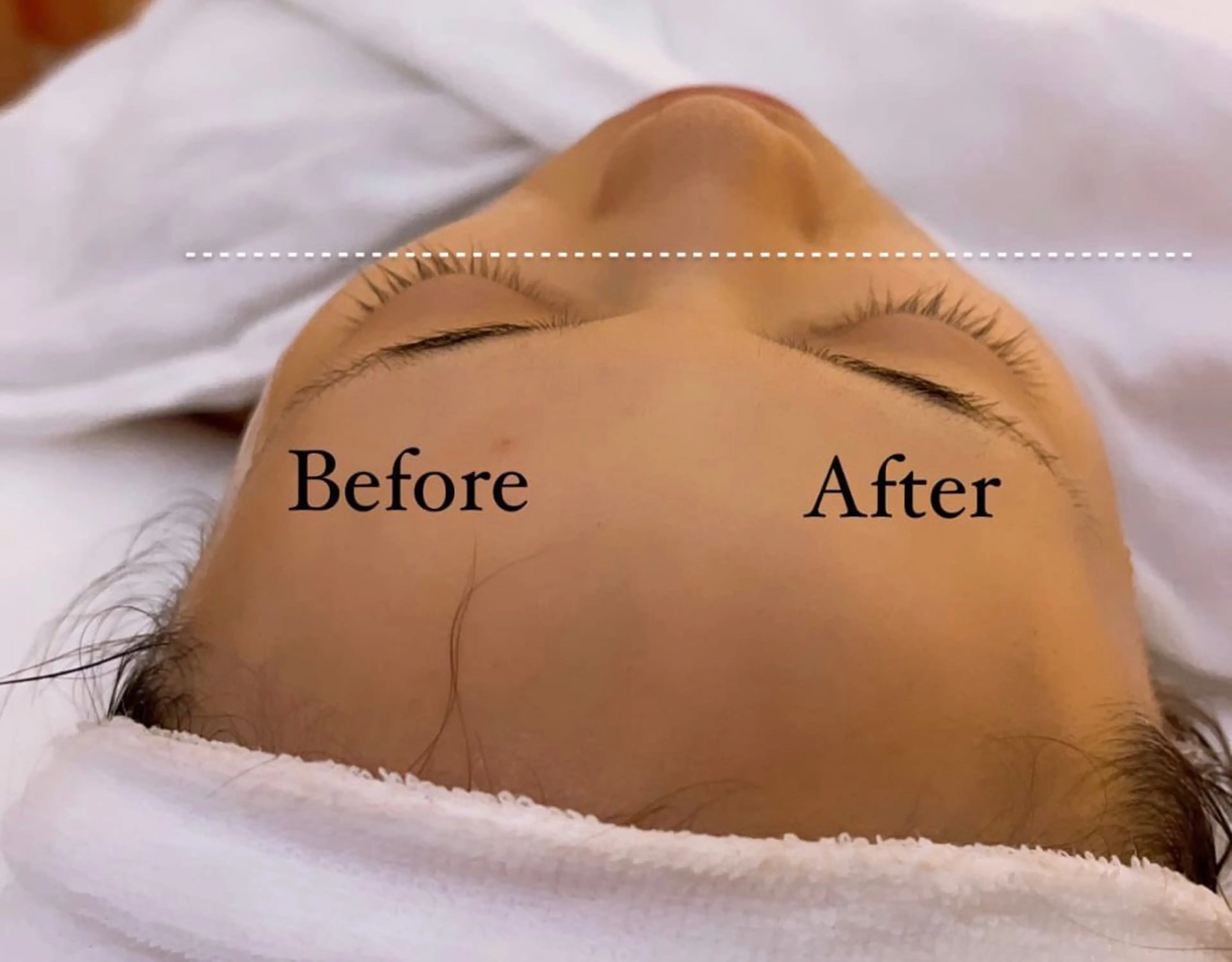 肌質改善サロン🌕 ⠀【ルーナピエナ】のエステ・リラクイメージ