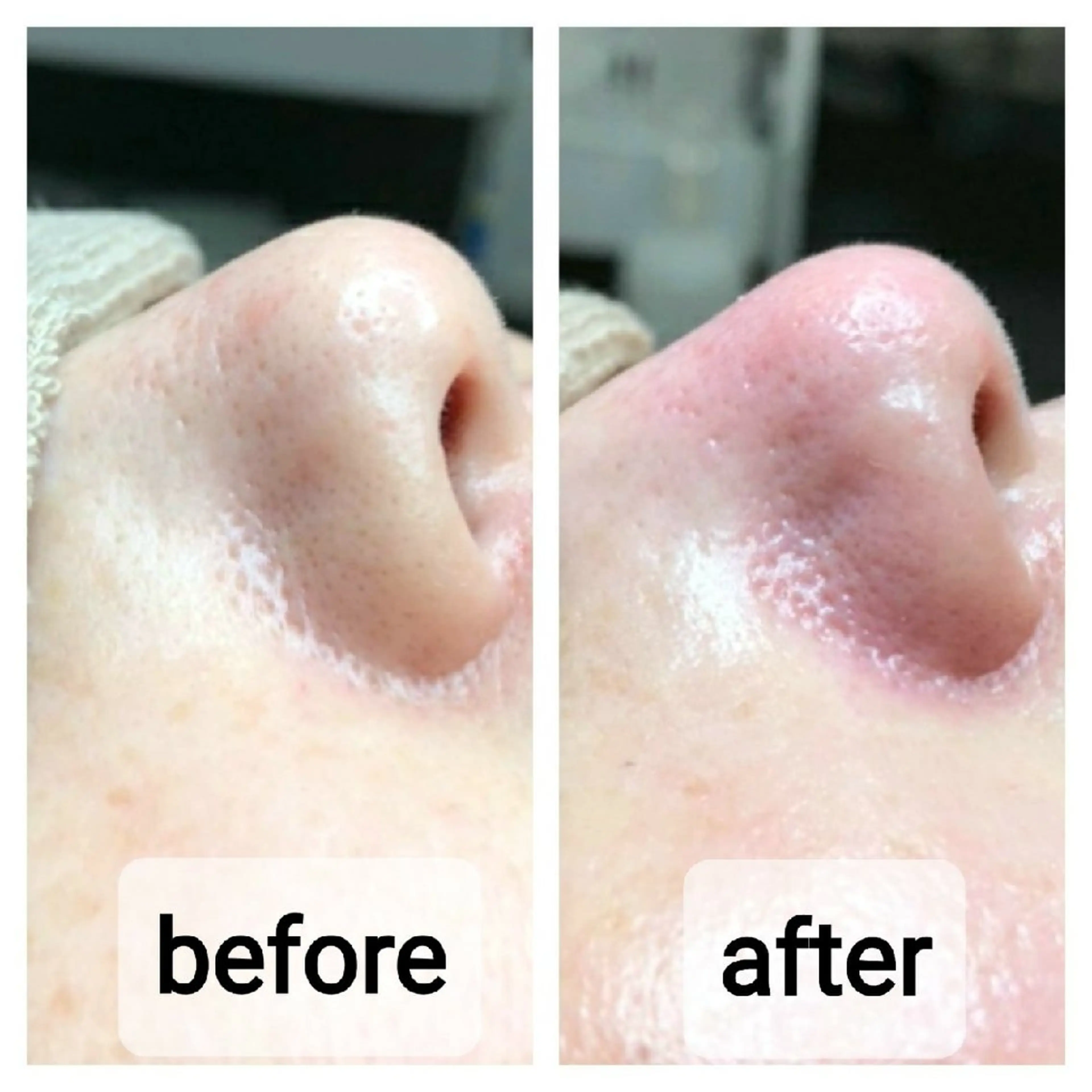 N.Sサロン Miyauchiのエステ・リラクイメージ