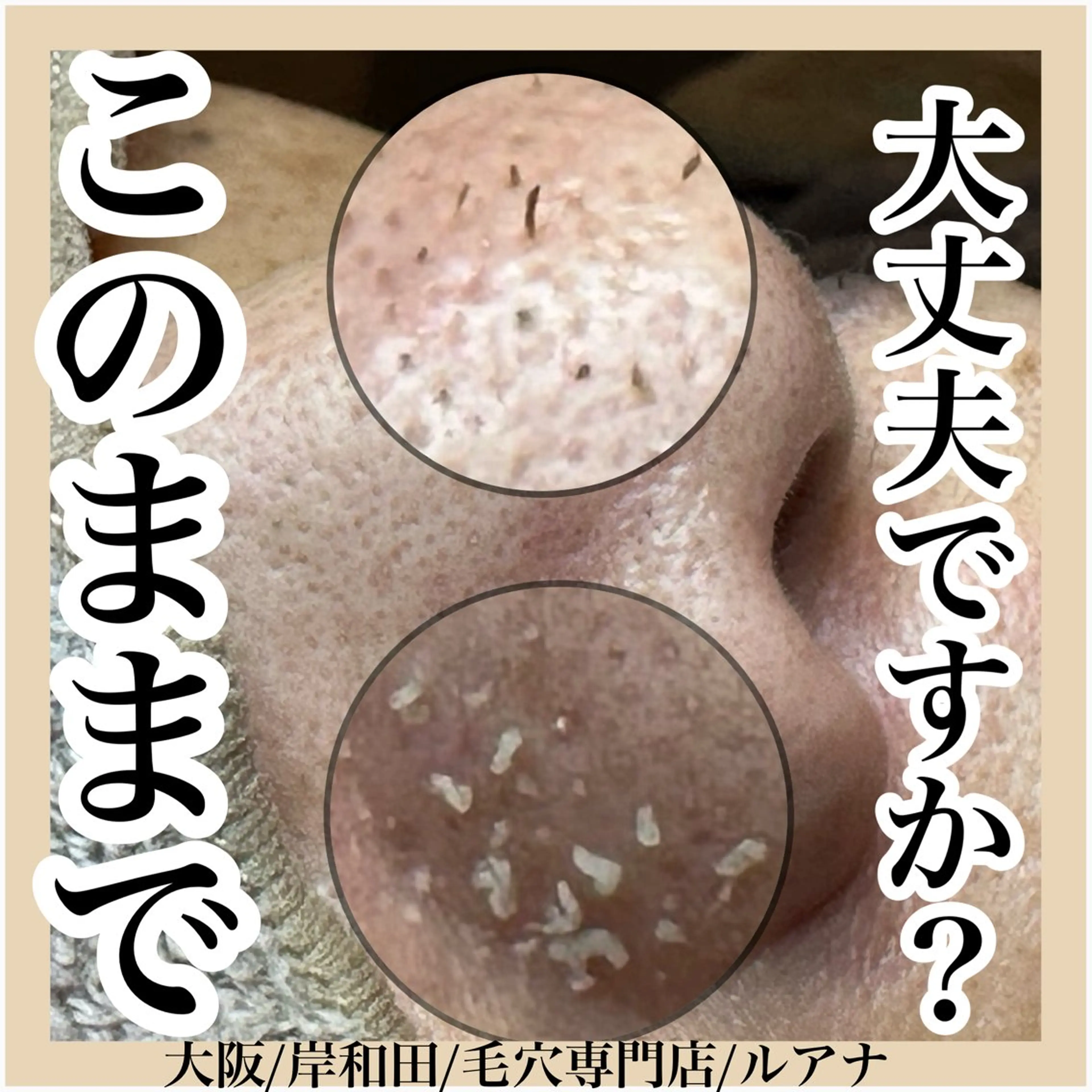 マツヤニWax専門/ 岸和田/Luanaのエステ・リラクイメージ