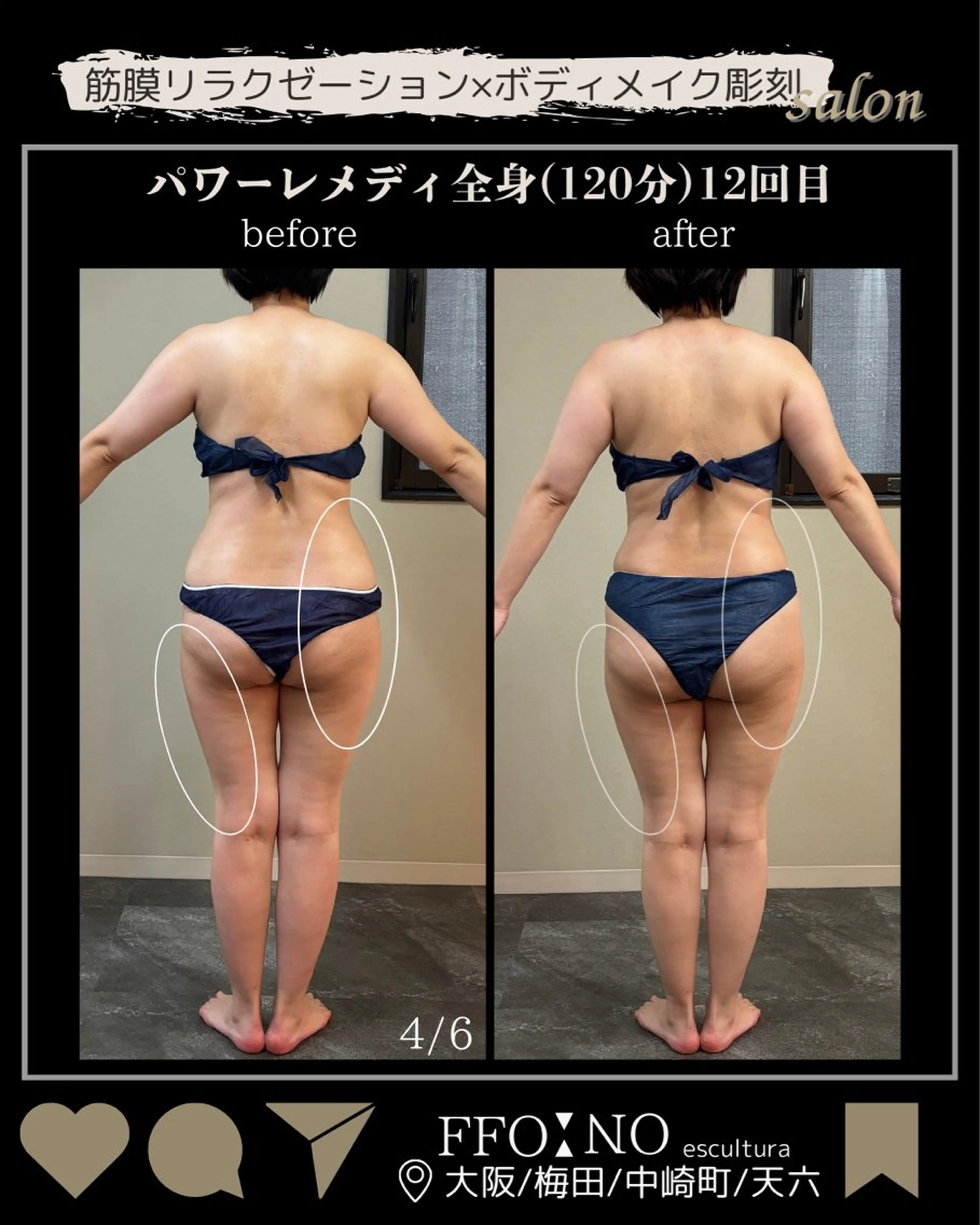 オフ:オン 全身筋膜マッサージのエステ・リラクイメージ