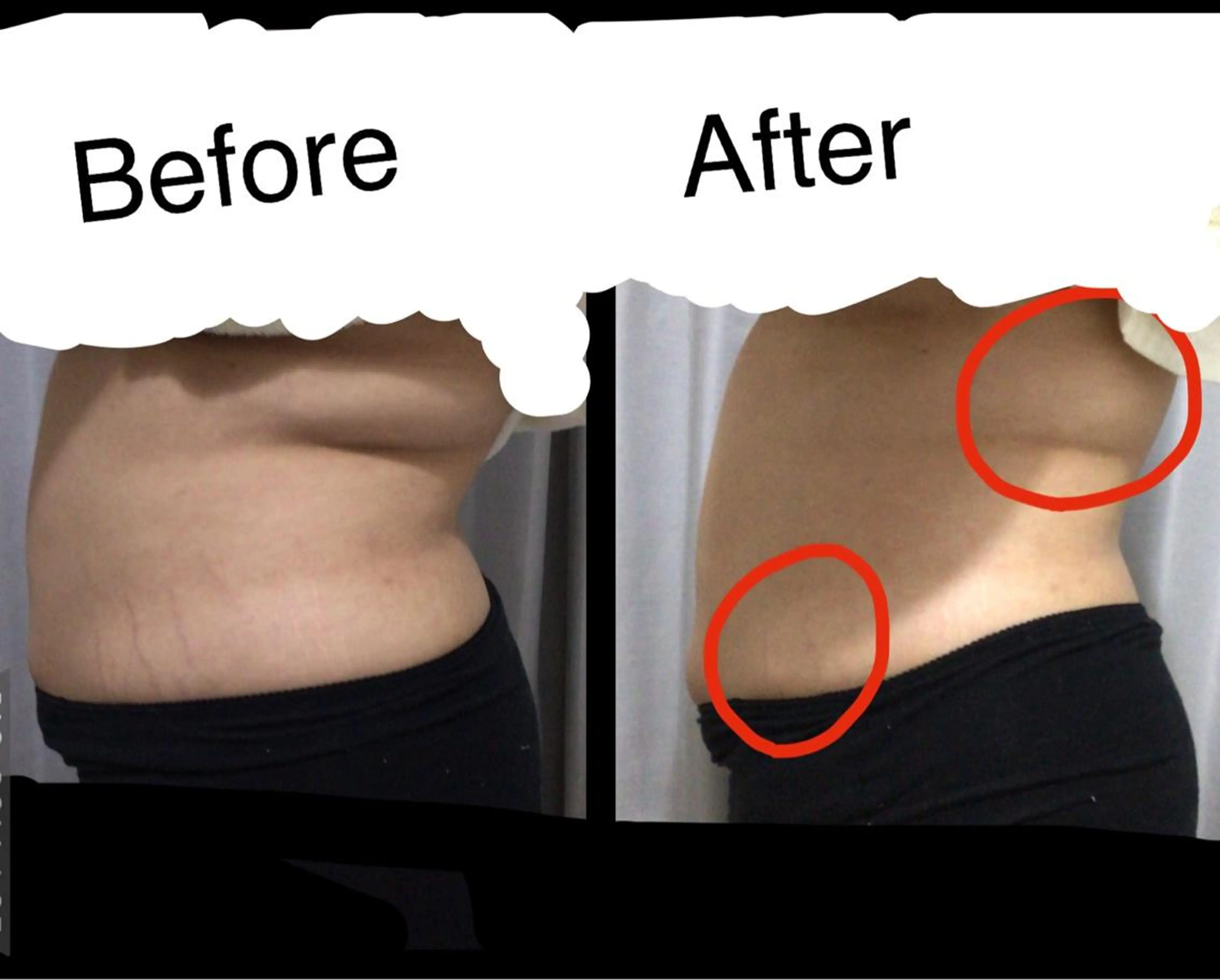 子宮矯正/腸揉み/ シュガーリング脱毛のエステ・リラクイメージ