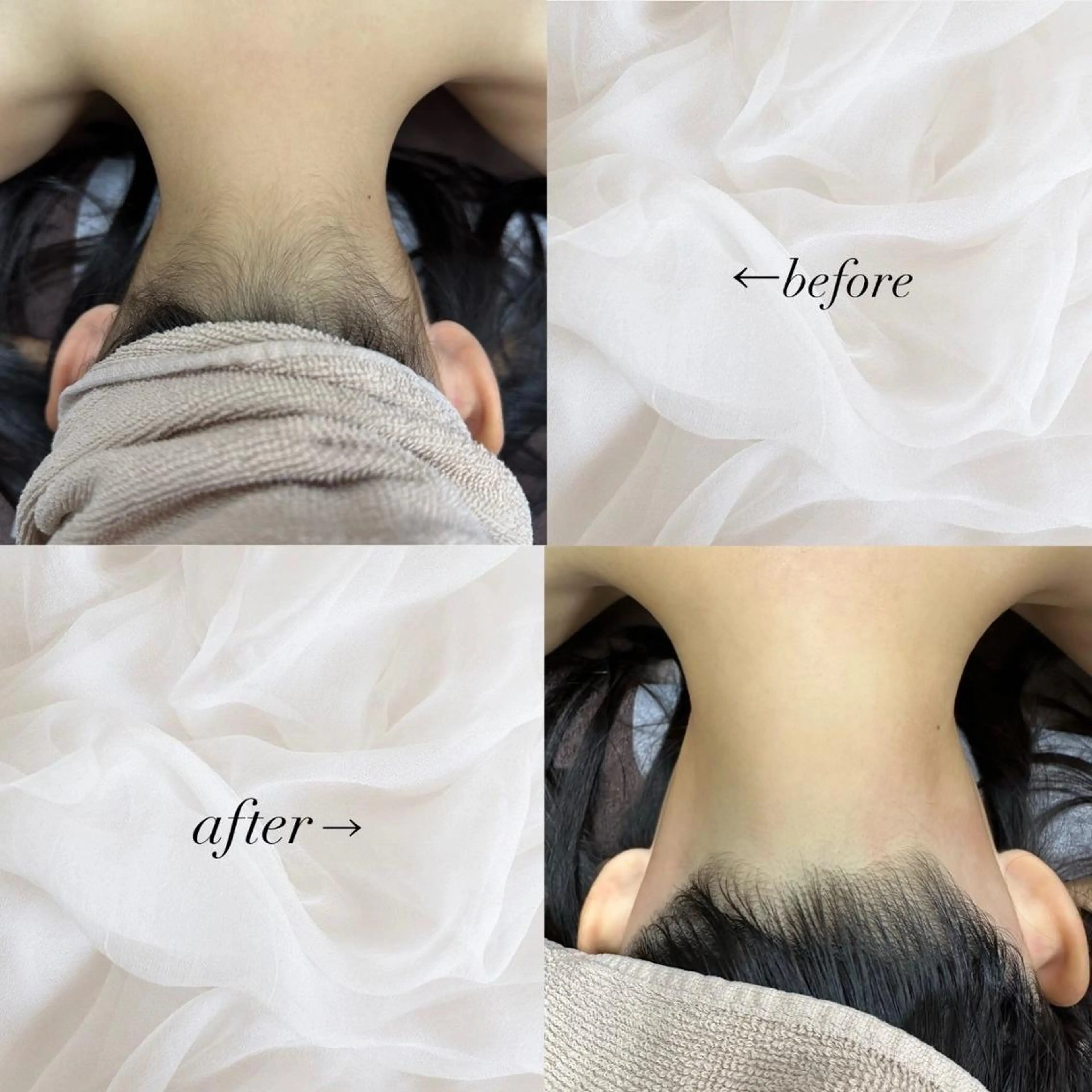 RinRin 豊田店のエステ・リラクイメージ