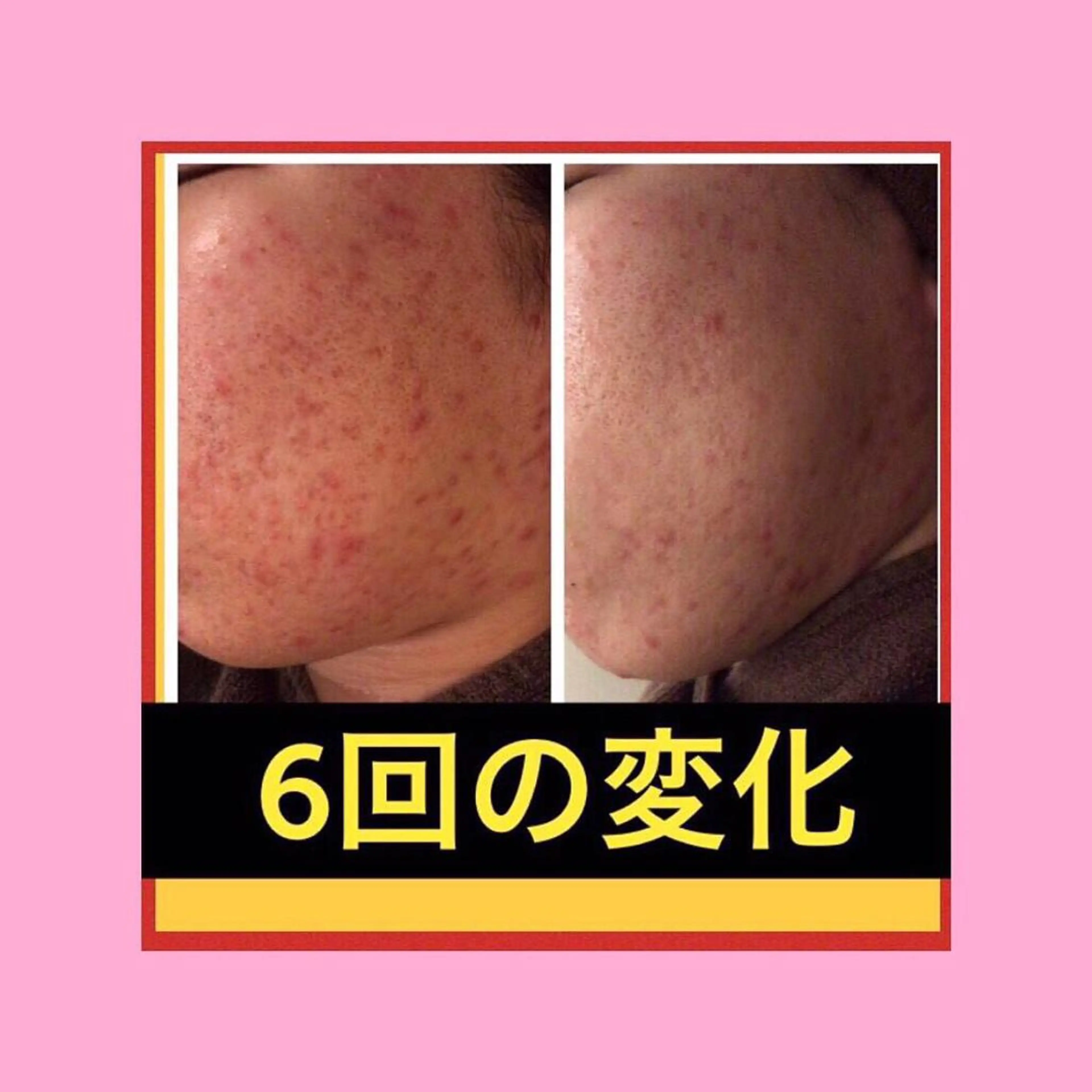 ミディアム カラー パーマ ヘアアレンジ メンズ キッズ ネイル マツエク・マツパ ニキビ・肌質改善専門 ♡人生が変わるサロンのエステ・リラクイメージ