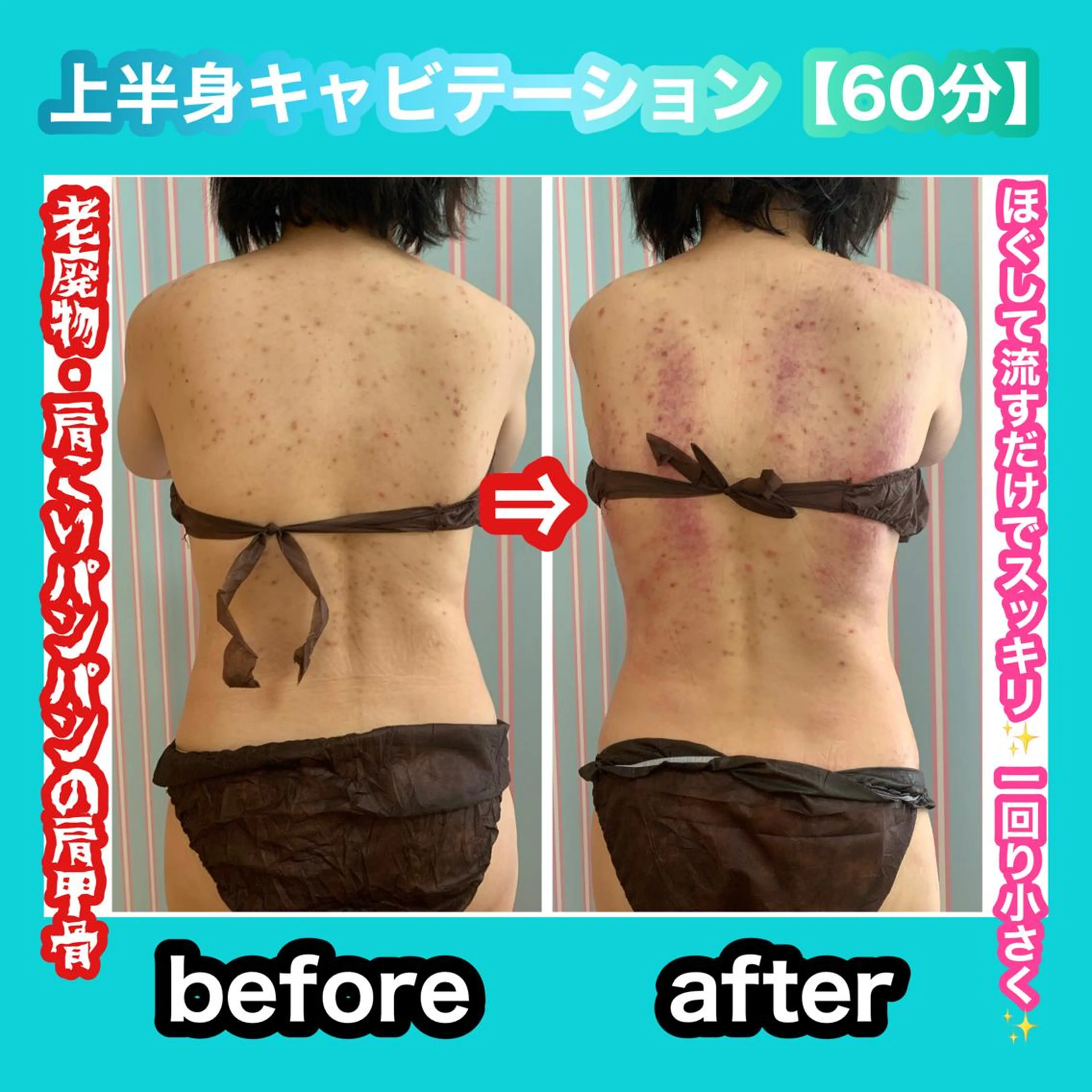 エステ リラク 痩身/脱毛/ネイル HARUKAのエステ・リラクイメージ