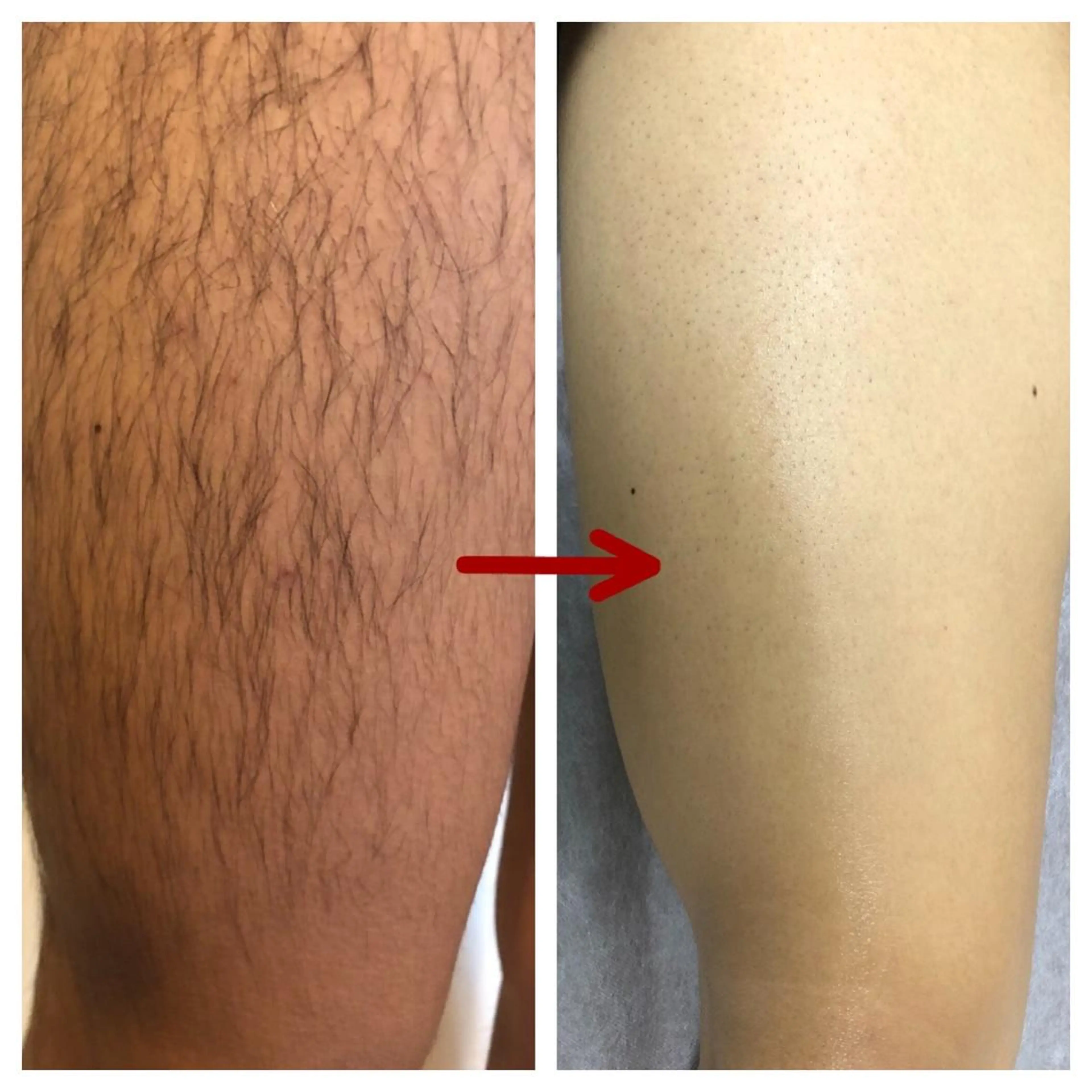 メンズ salon   de epilaのエステ・リラクイメージ