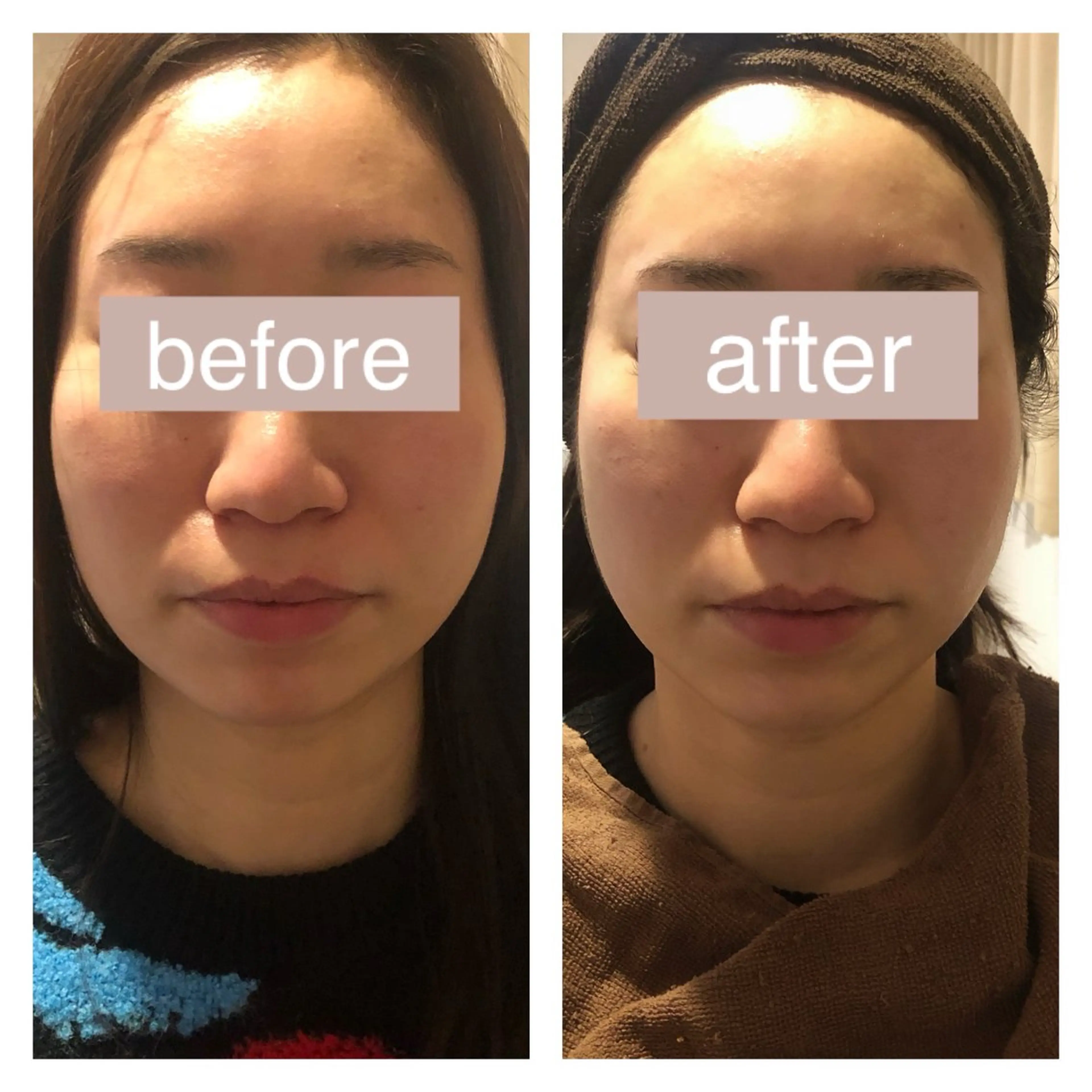 エステ 毛穴ニキビ専門 ビューティーグランツのエステ・リラクイメージ