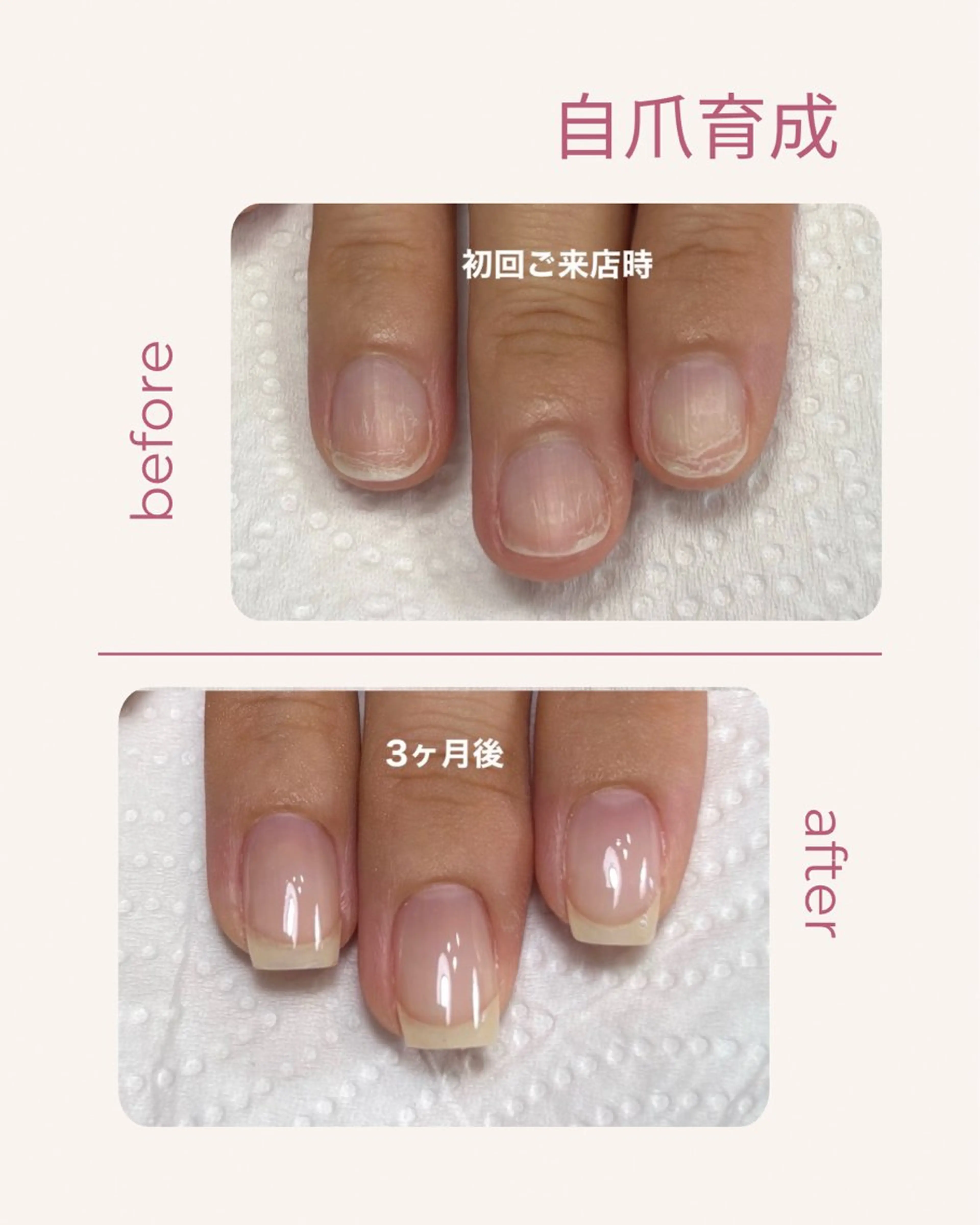 期間限定価格【自爪育成】短い爪から整えるクリア育成✨“変化が出る”自爪育成専門メニューの写真
